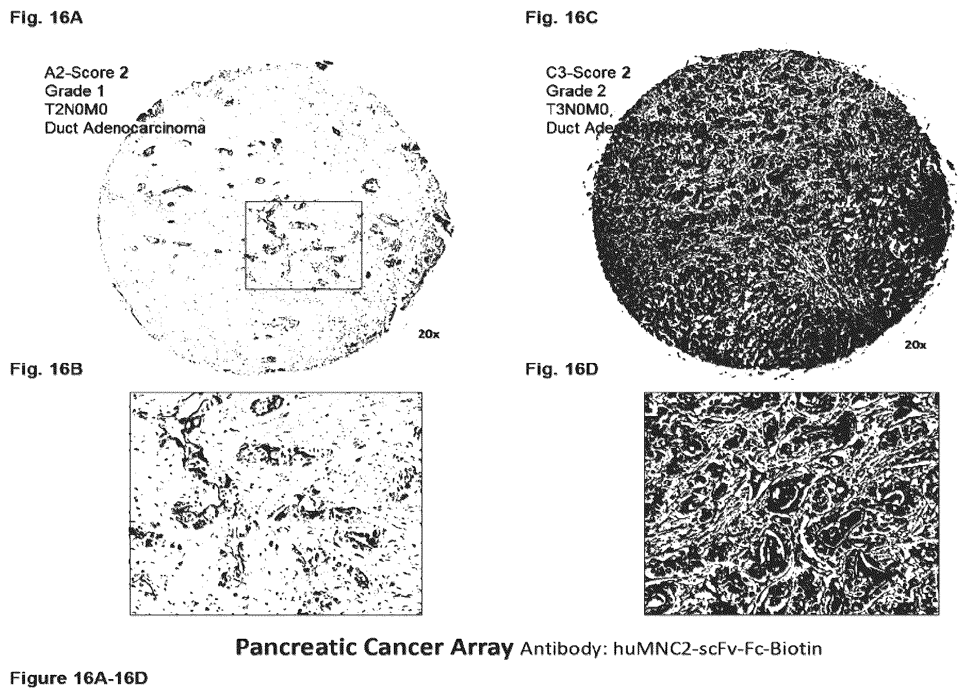Patent US12351646 Figure 16 – Diagnostic methods using anti-MUC1* antibodies