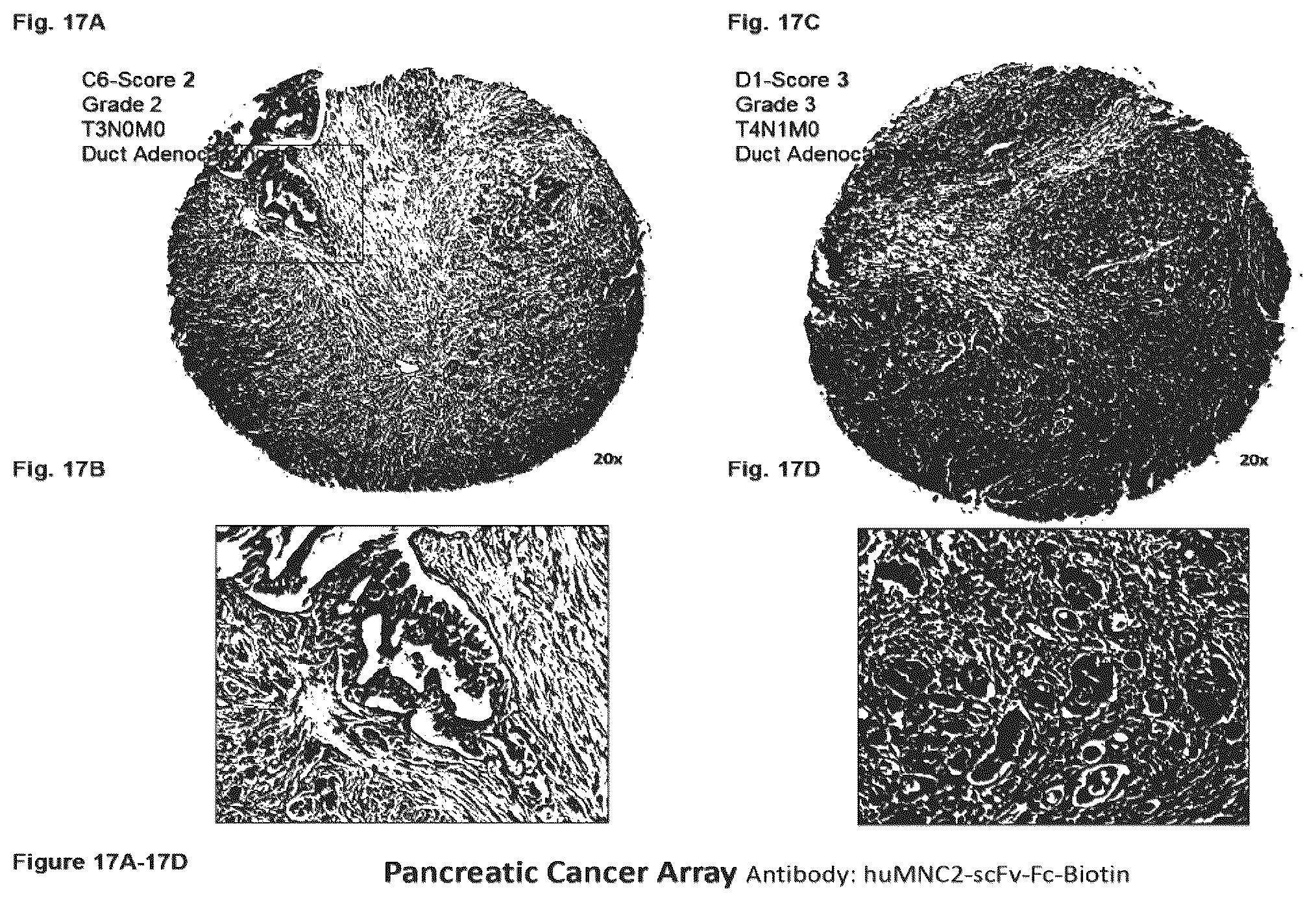 Patent US12351646 Figure 17 – Diagnostic methods using anti-MUC1* antibodies