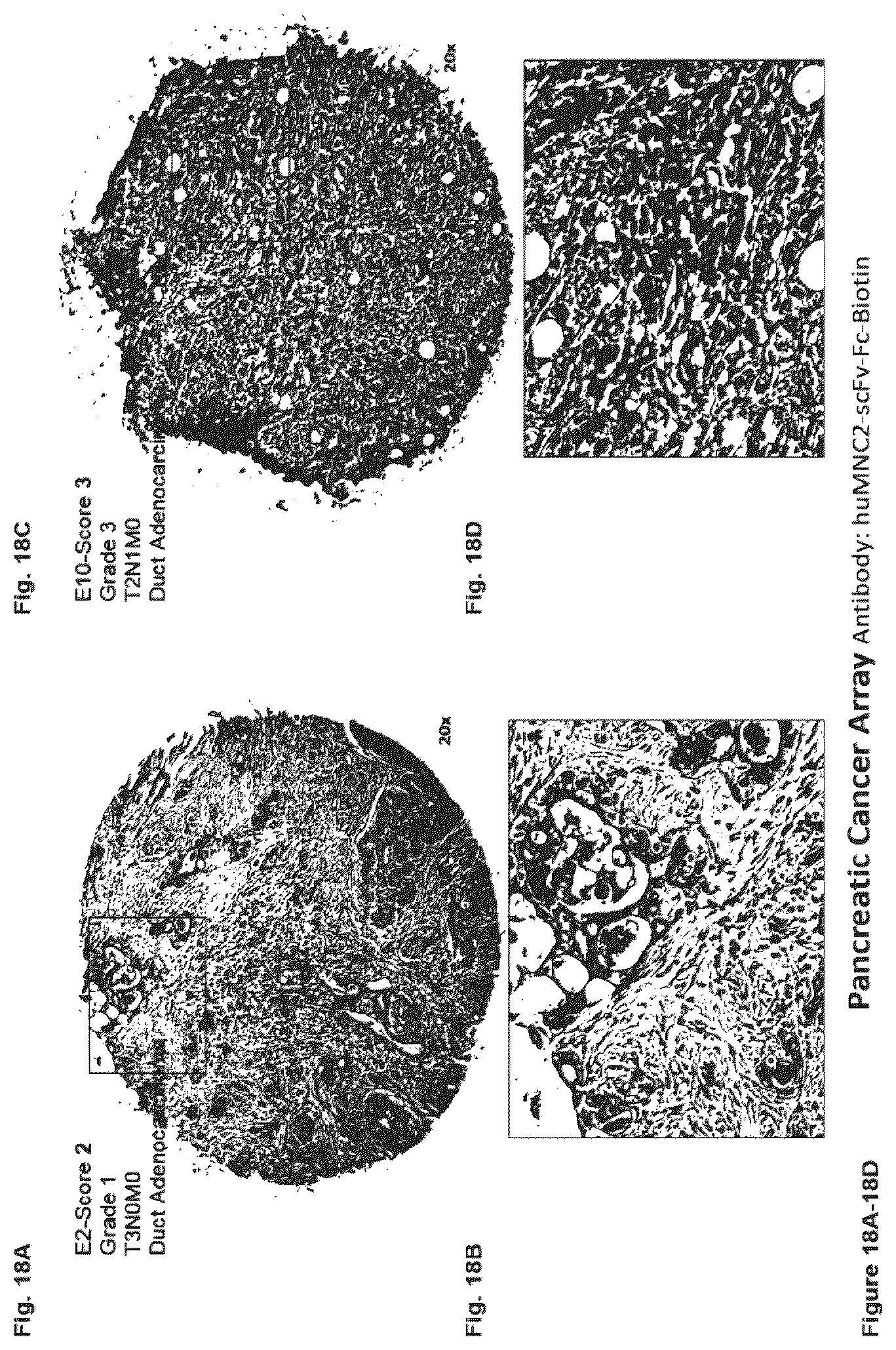 Patent US12351646 Figure 18 – Diagnostic methods using anti-MUC1* antibodies