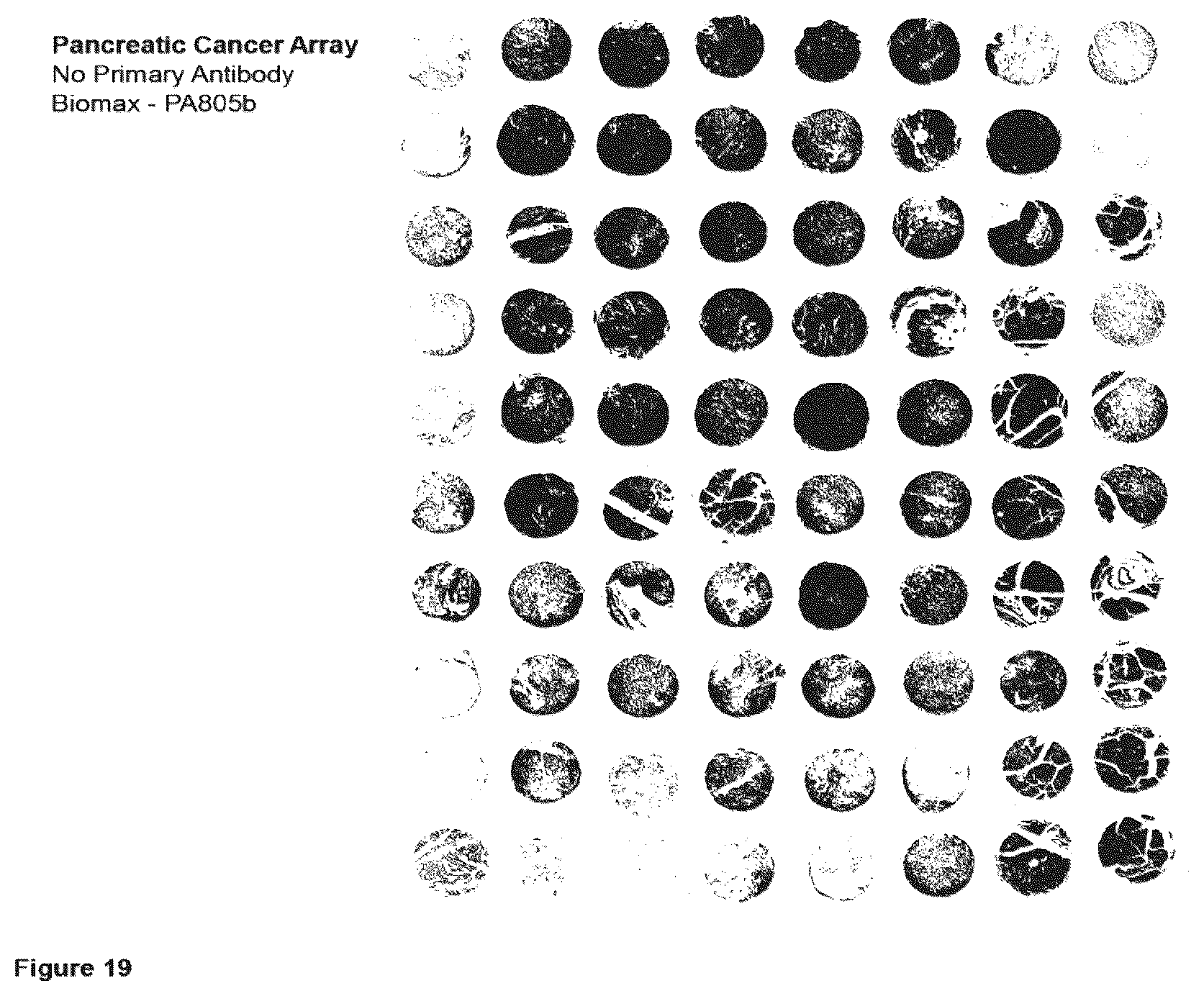 Patent US12351646 Figure 19 – Diagnostic methods using anti-MUC1* antibodies