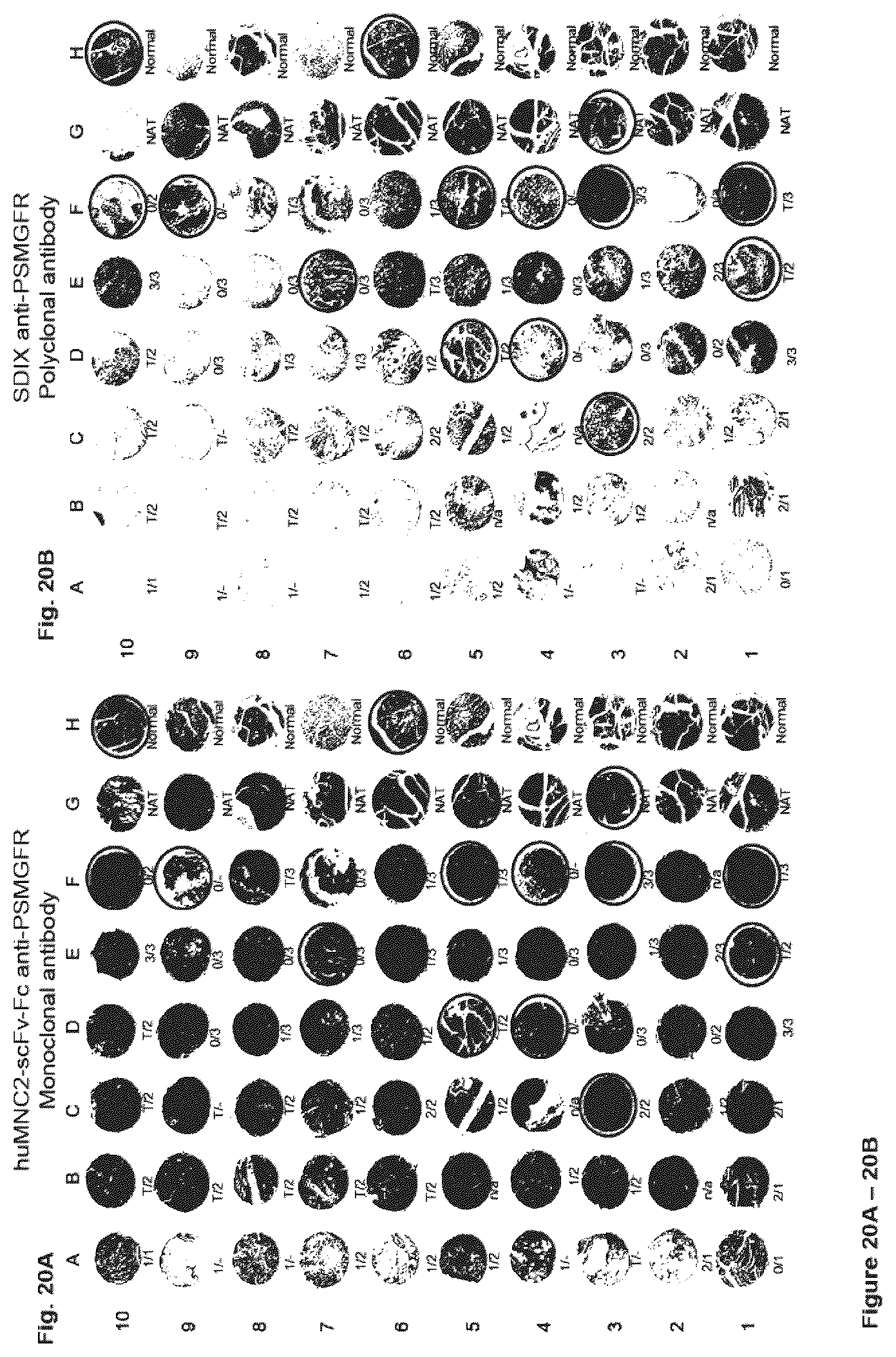 Patent US12351646 Figure 20 – Diagnostic methods using anti-MUC1* antibodies