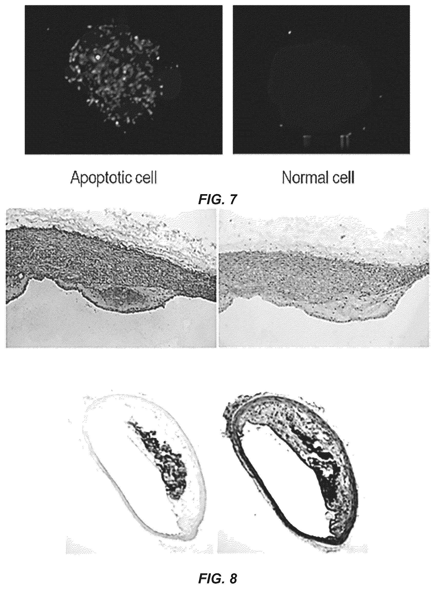 Patent US12351649 Figure 11 – Antibodies to oxidation-specific epitopes
