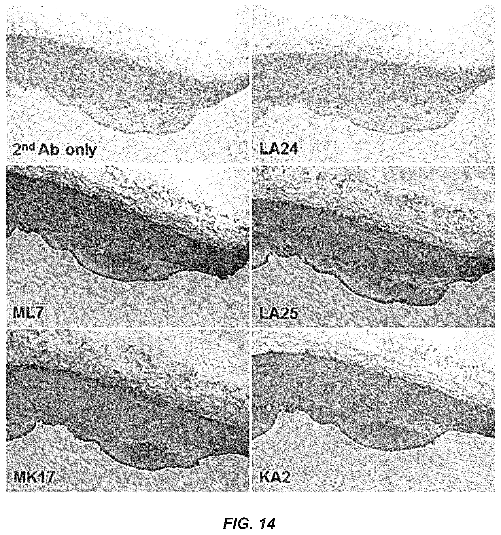 Patent US12351649 Figure 16 – Antibodies to oxidation-specific epitopes