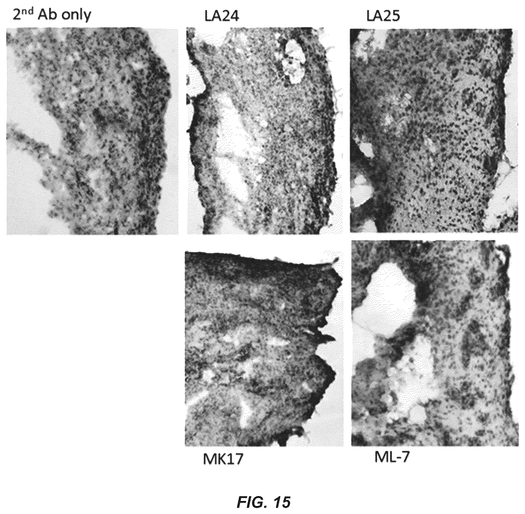 Patent US12351649 Figure 17 – Antibodies to oxidation-specific epitopes