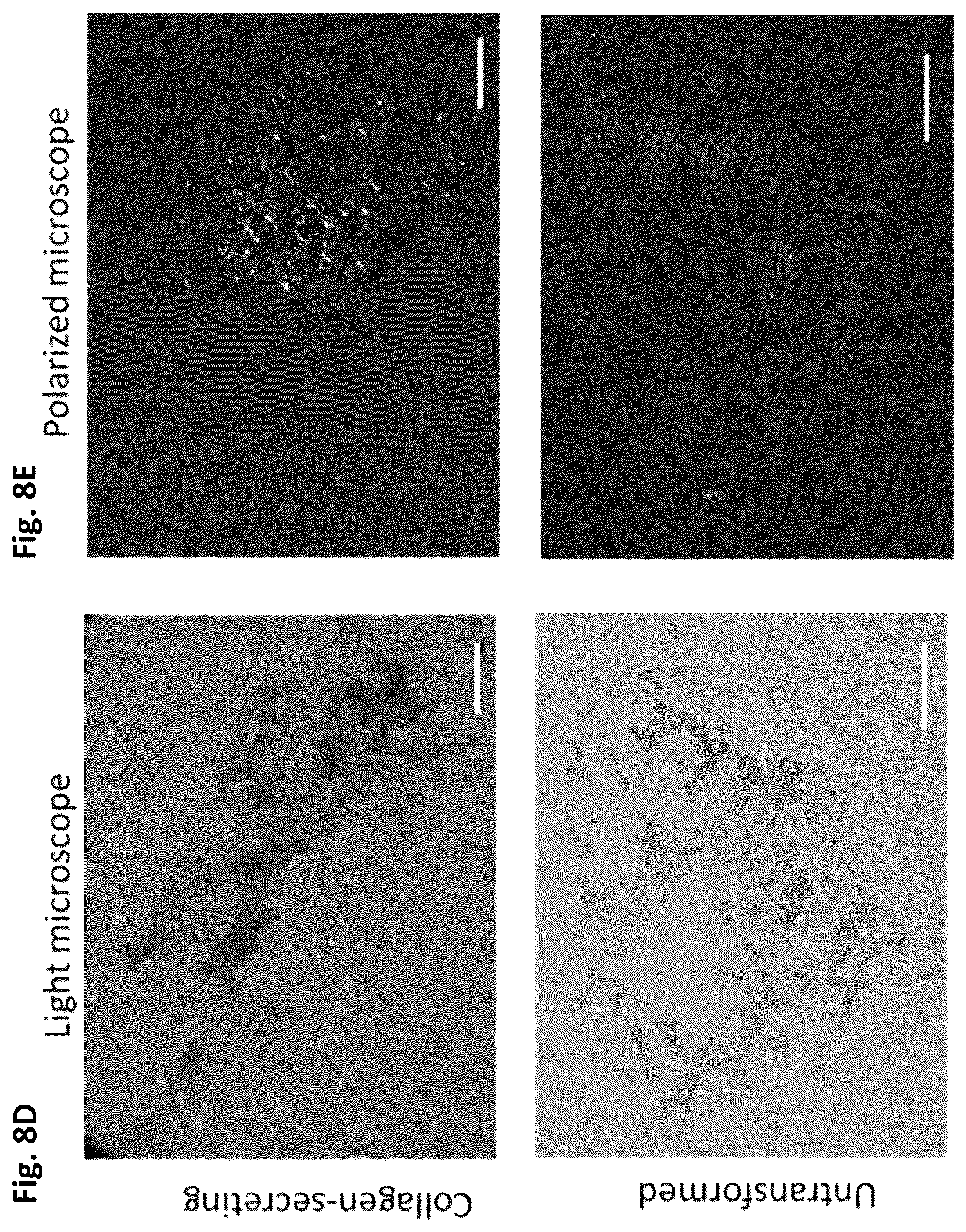 Patent US12351805 Figure 11 – Method of making recombinant silk and silk-amyloid hybrid proteins using bacteria