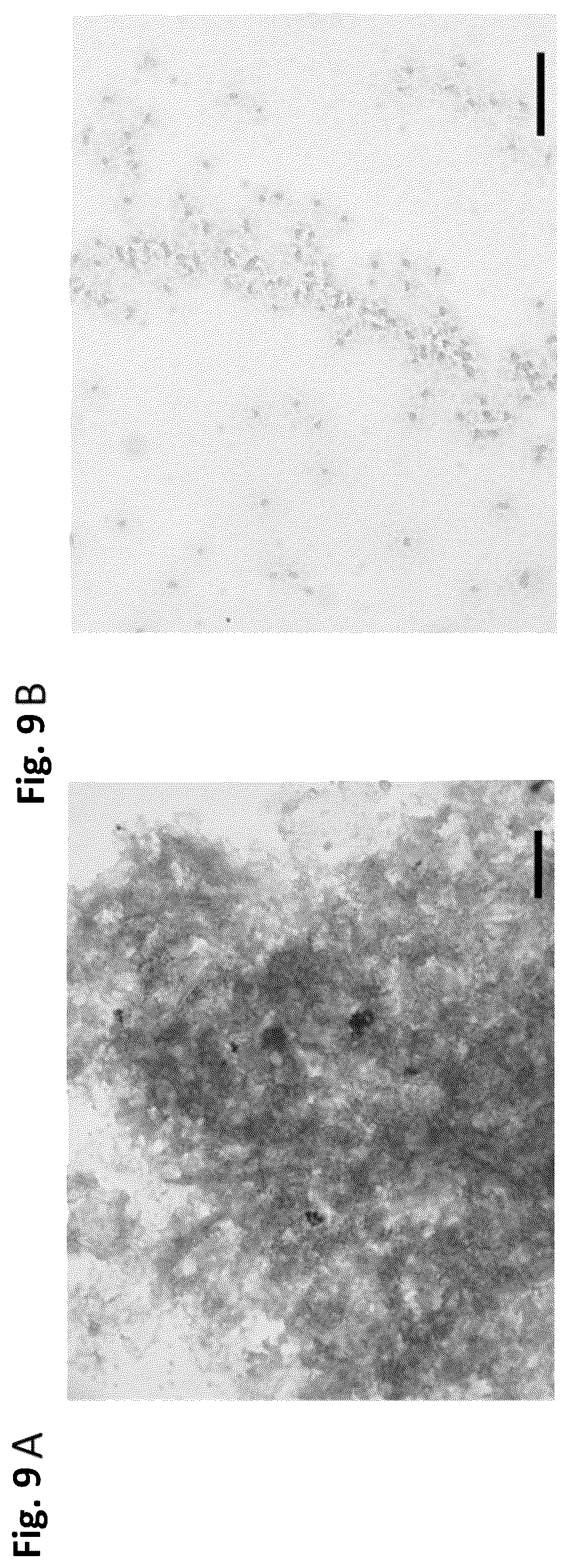 Patent US12351805 Figure 12 – Method of making recombinant silk and silk-amyloid hybrid proteins using bacteria