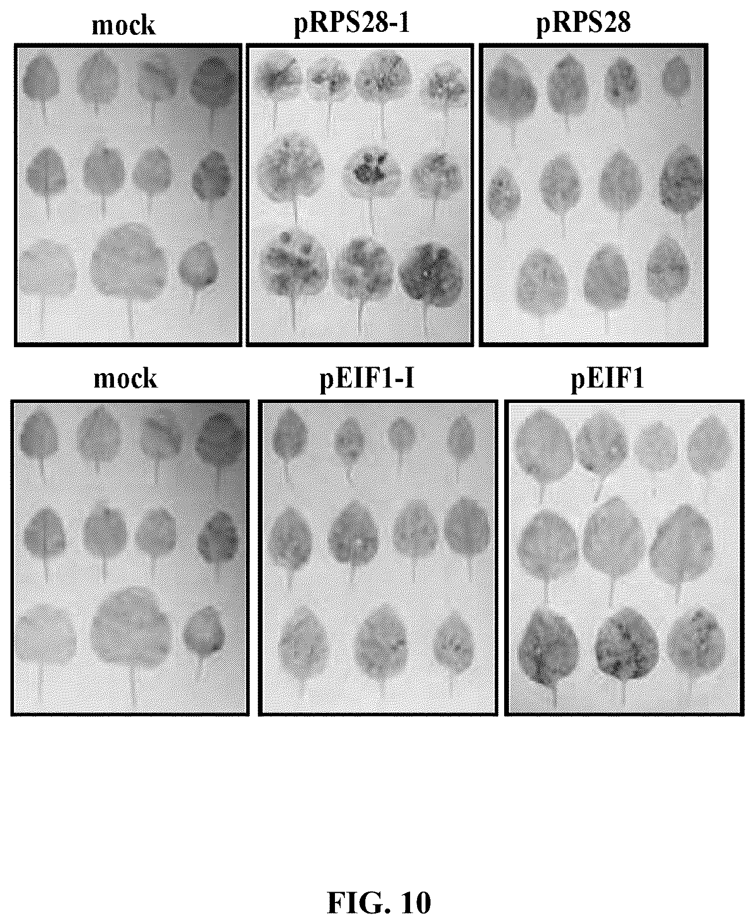 Patent US12351808 Figure 20 – Method for promoting expression of foreign gene in soybean, Arabidopsis or tobacco using gene promoter PRPS28 or PRPS28-1