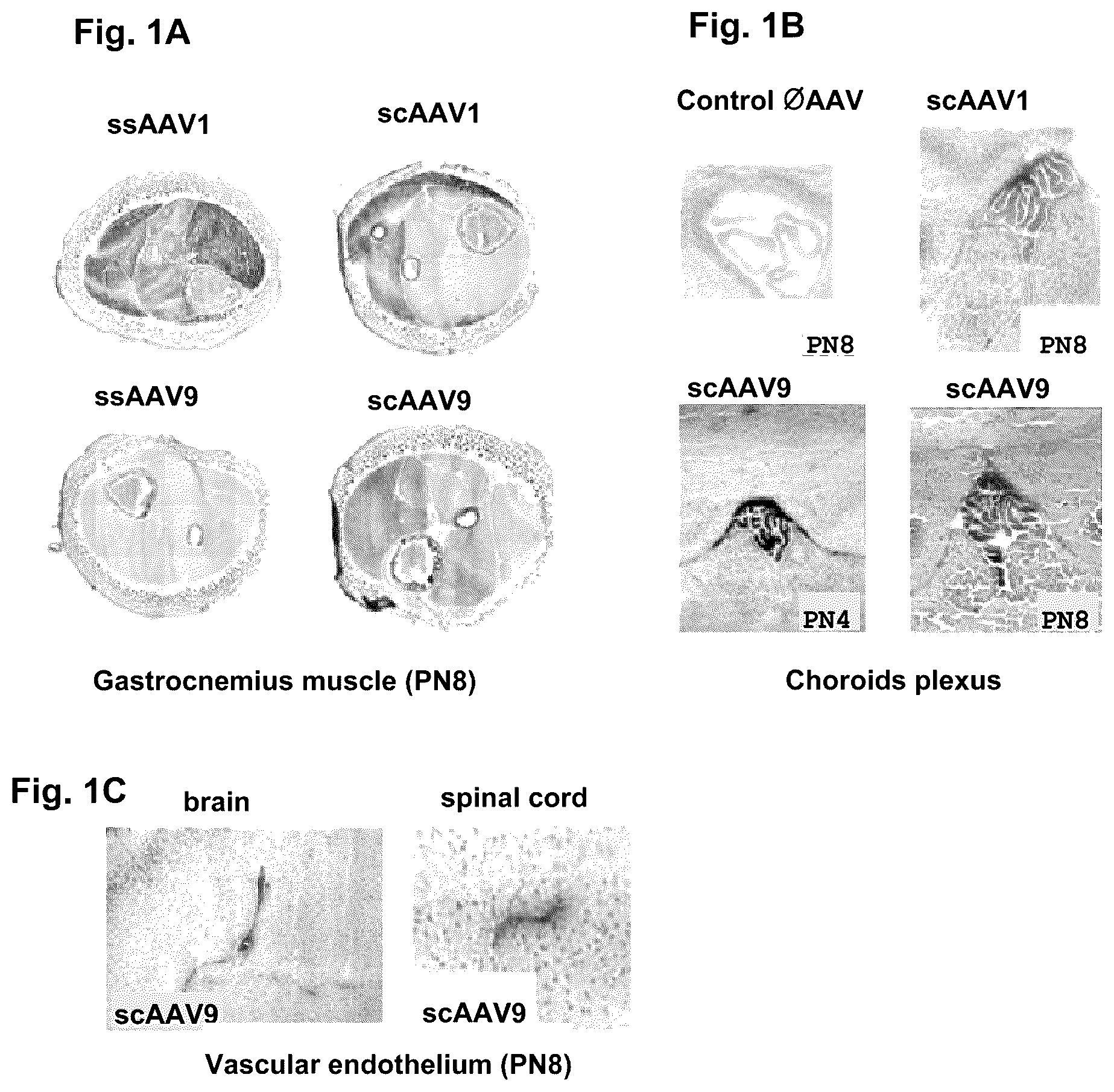 Patent US12351816 Figure 1 – CNS gene delivery using peripheral administration of AAV vectors