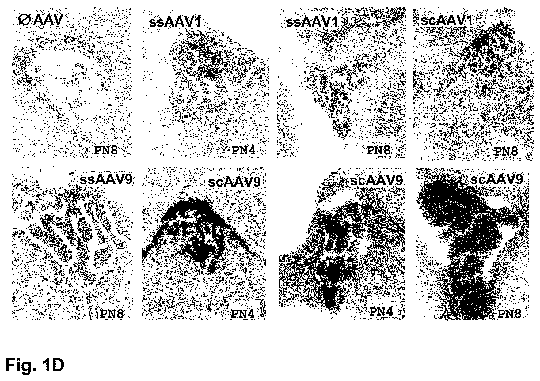 Patent US12351816 Figure 2 – CNS gene delivery using peripheral administration of AAV vectors