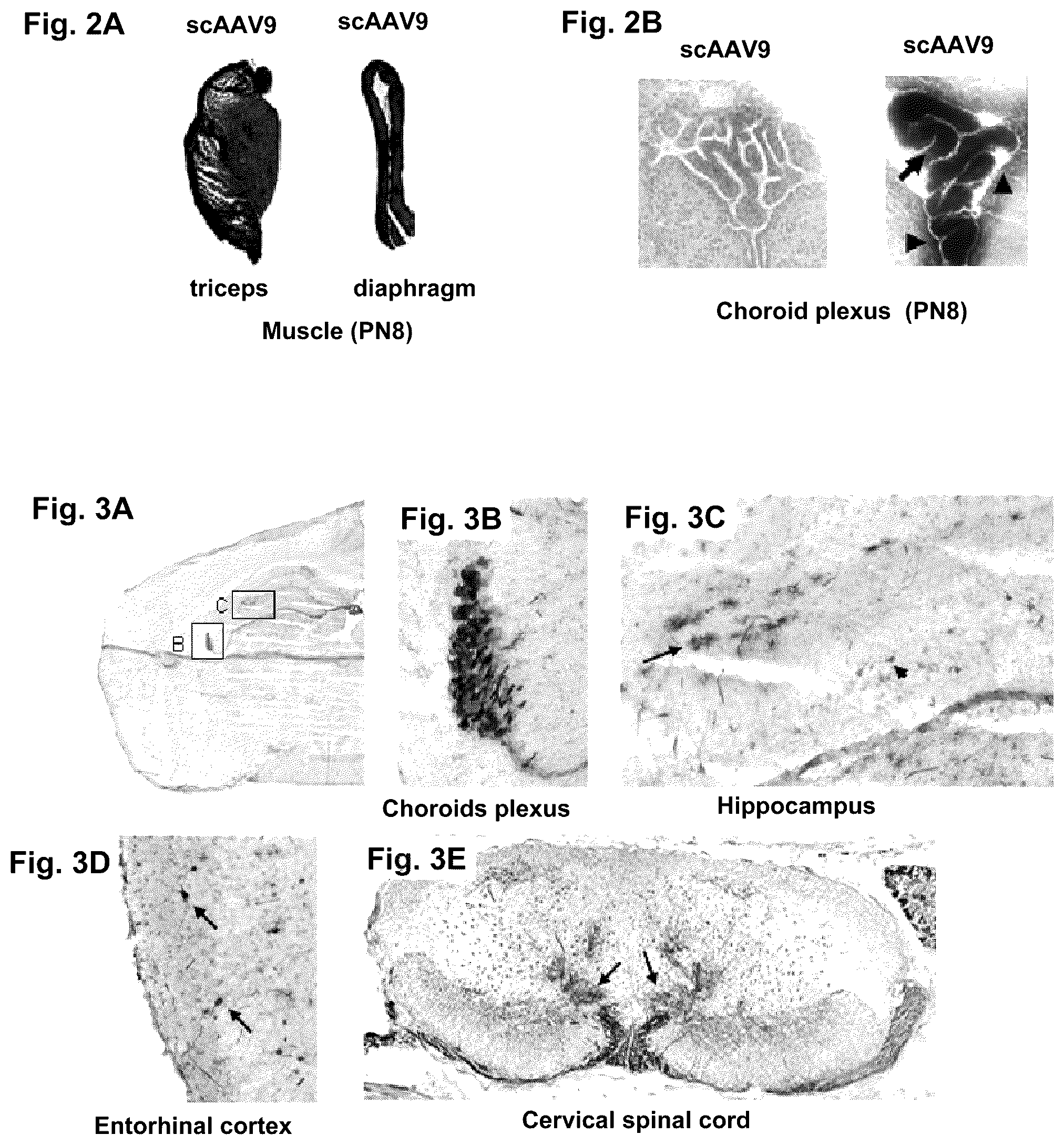 Patent US12351816 Figure 3 – CNS gene delivery using peripheral administration of AAV vectors