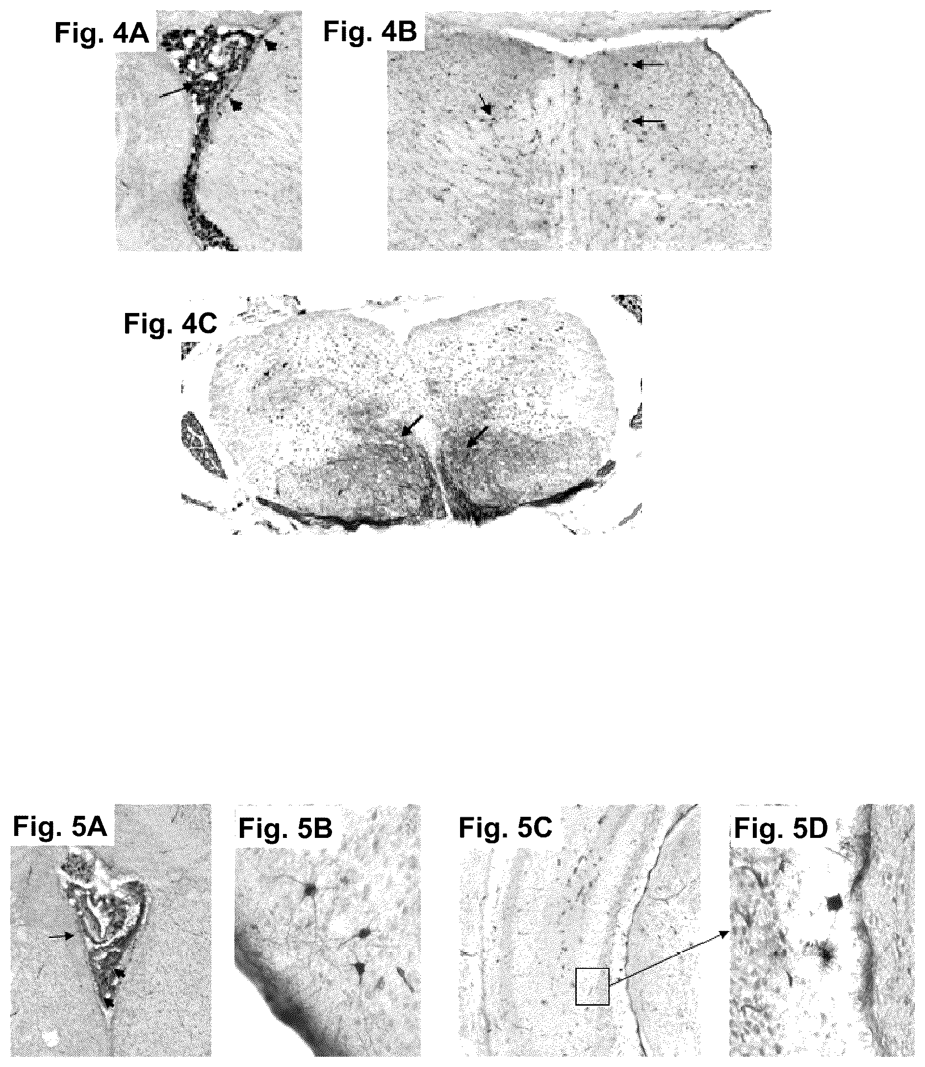 Patent US12351816 Figure 4 – CNS gene delivery using peripheral administration of AAV vectors