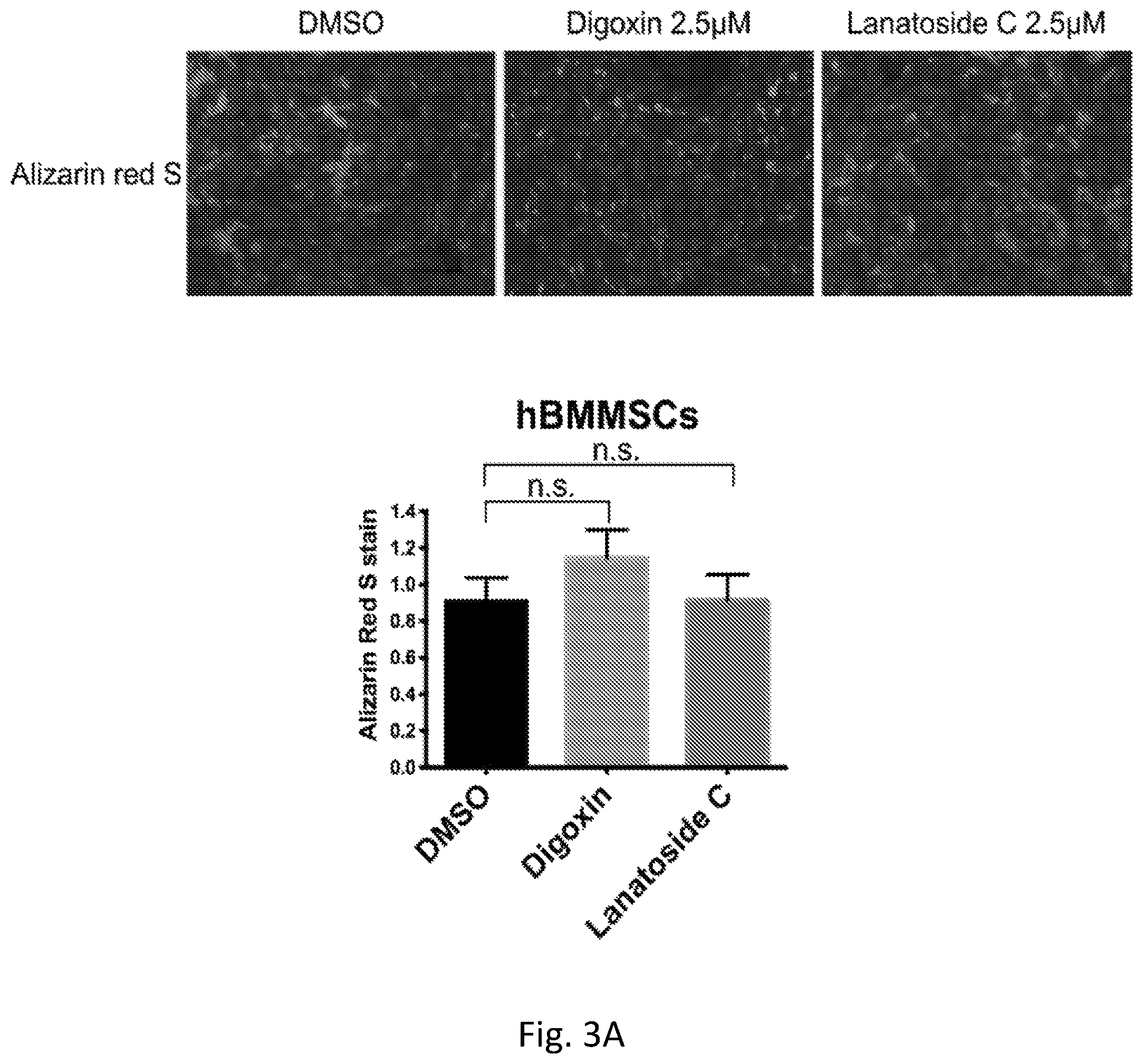 Patent US12351819 Figure 7 – Method for removing undifferentiated pluripotent stem cells