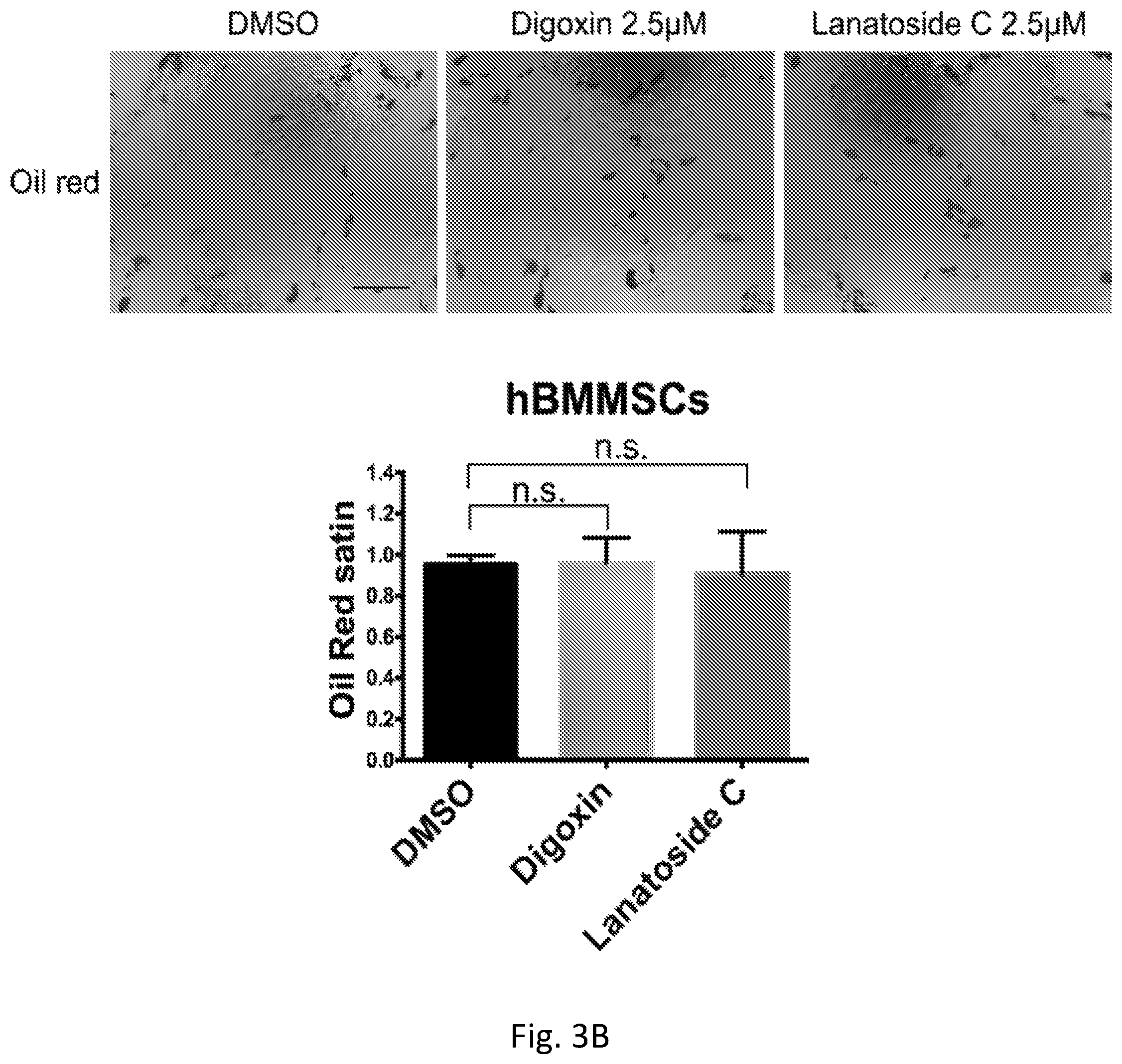 Patent US12351819 Figure 8 – Method for removing undifferentiated pluripotent stem cells