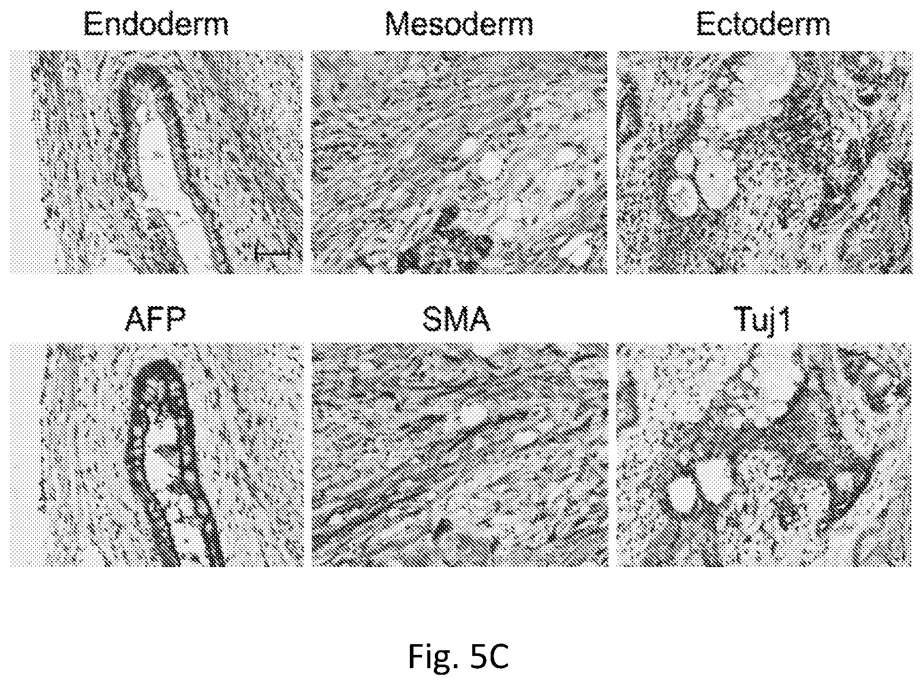 Patent US12351819 Figure 14 – Method for removing undifferentiated pluripotent stem cells