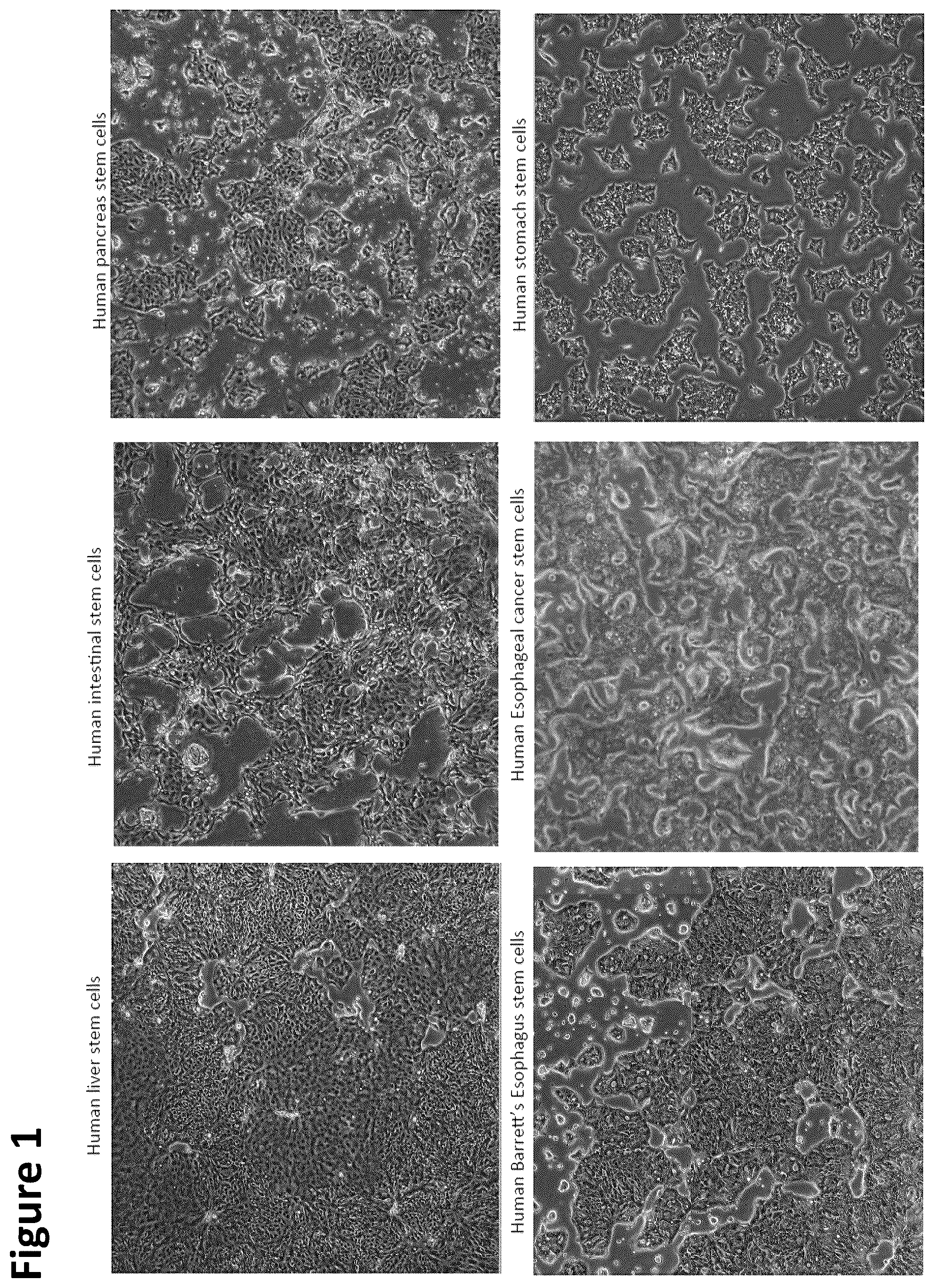 Patent US12351822 Figure 1 – Stem cell culture systems for columnar epithelial stem cells, and uses related thereto