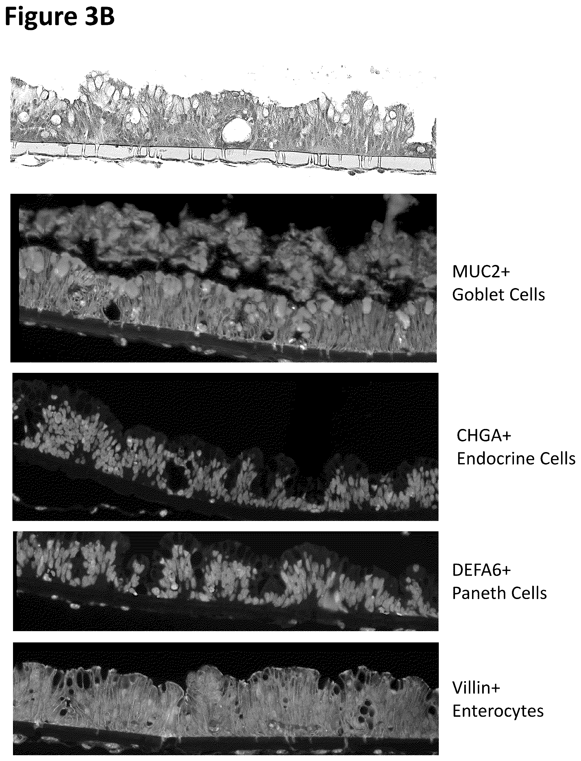 Patent US12351822 Figure 4 – Stem cell culture systems for columnar epithelial stem cells, and uses related thereto