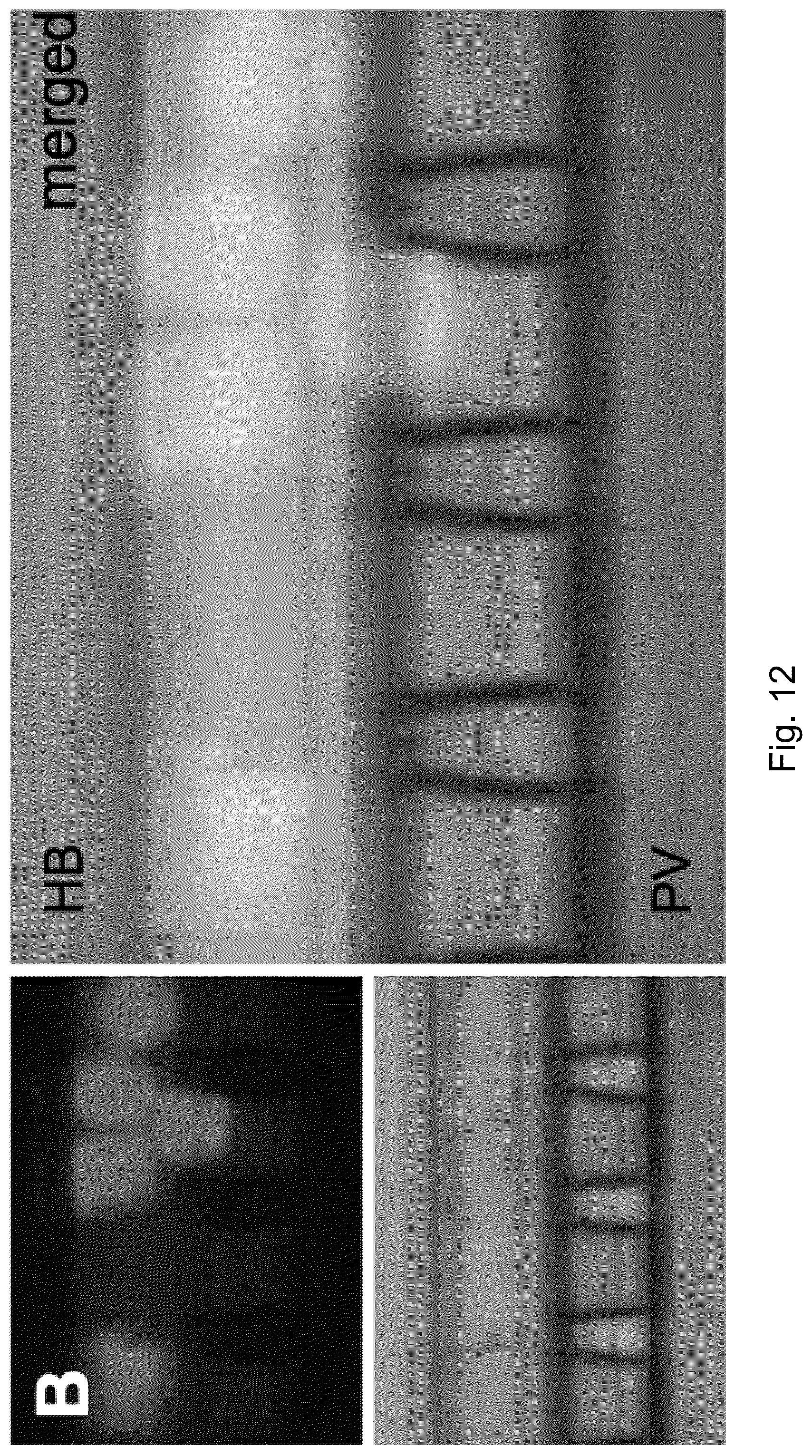 Patent US12351827 Figure 12 – Systems and methods fabricating a microchannel vascular network device and seeding a microchannel