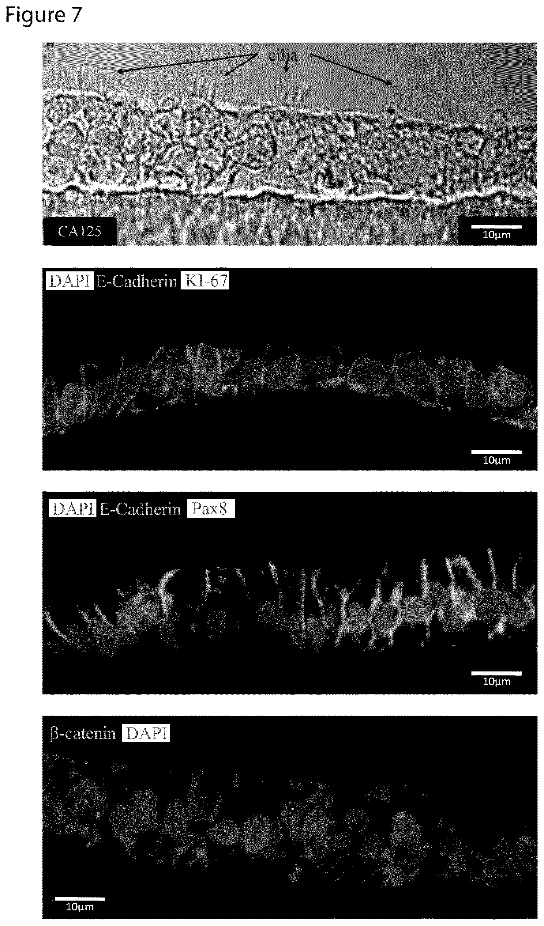 Patent US12351829 Figure 7 – Generation, proliferation and expansion of epithelial cells from primary tissue into mucosoid cultures