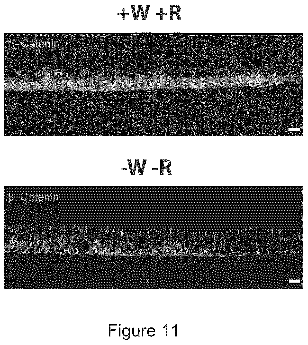Patent US12351829 Figure 11 – Generation, proliferation and expansion of epithelial cells from primary tissue into mucosoid cultures