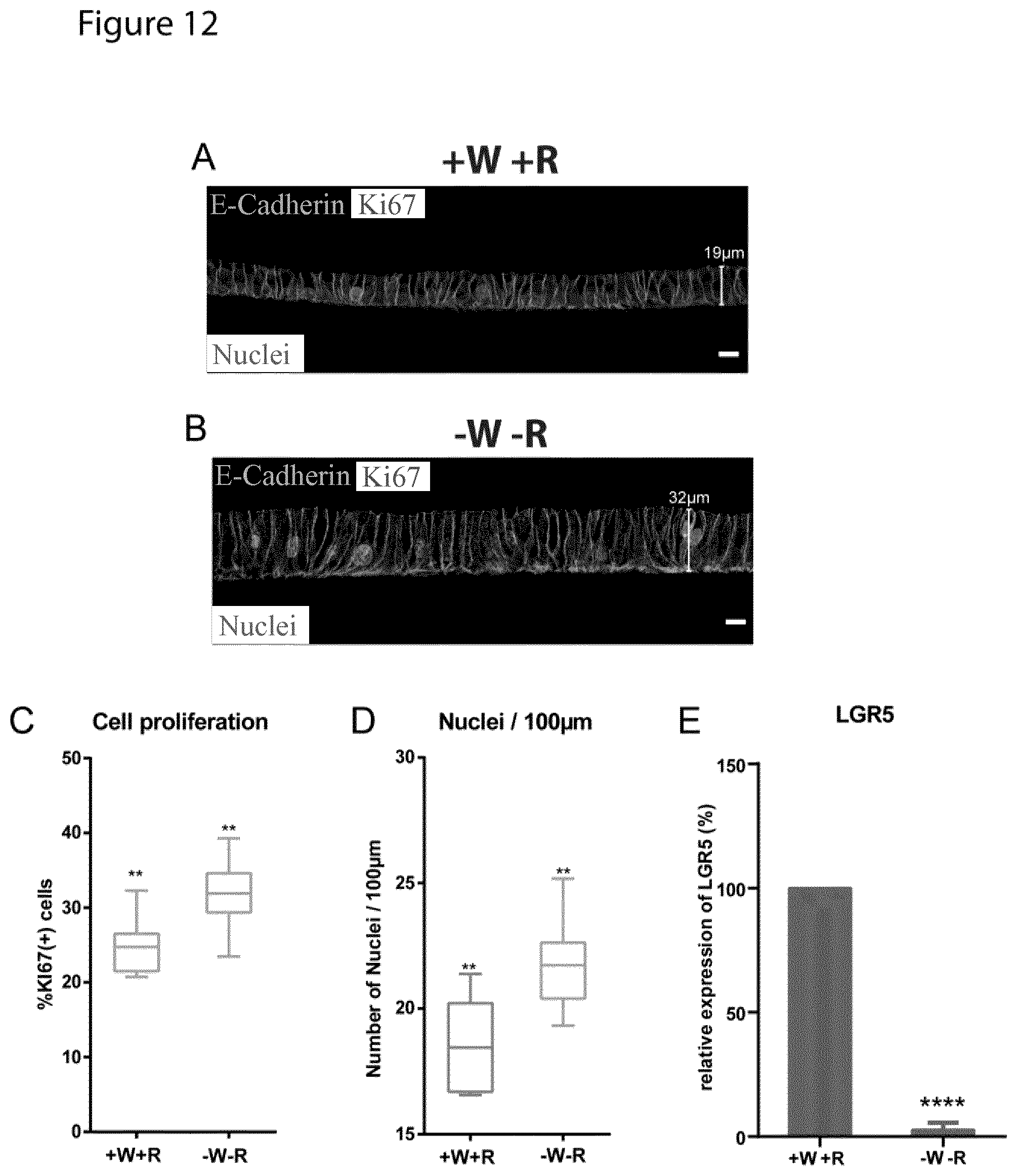 Patent US12351829 Figure 12 – Generation, proliferation and expansion of epithelial cells from primary tissue into mucosoid cultures