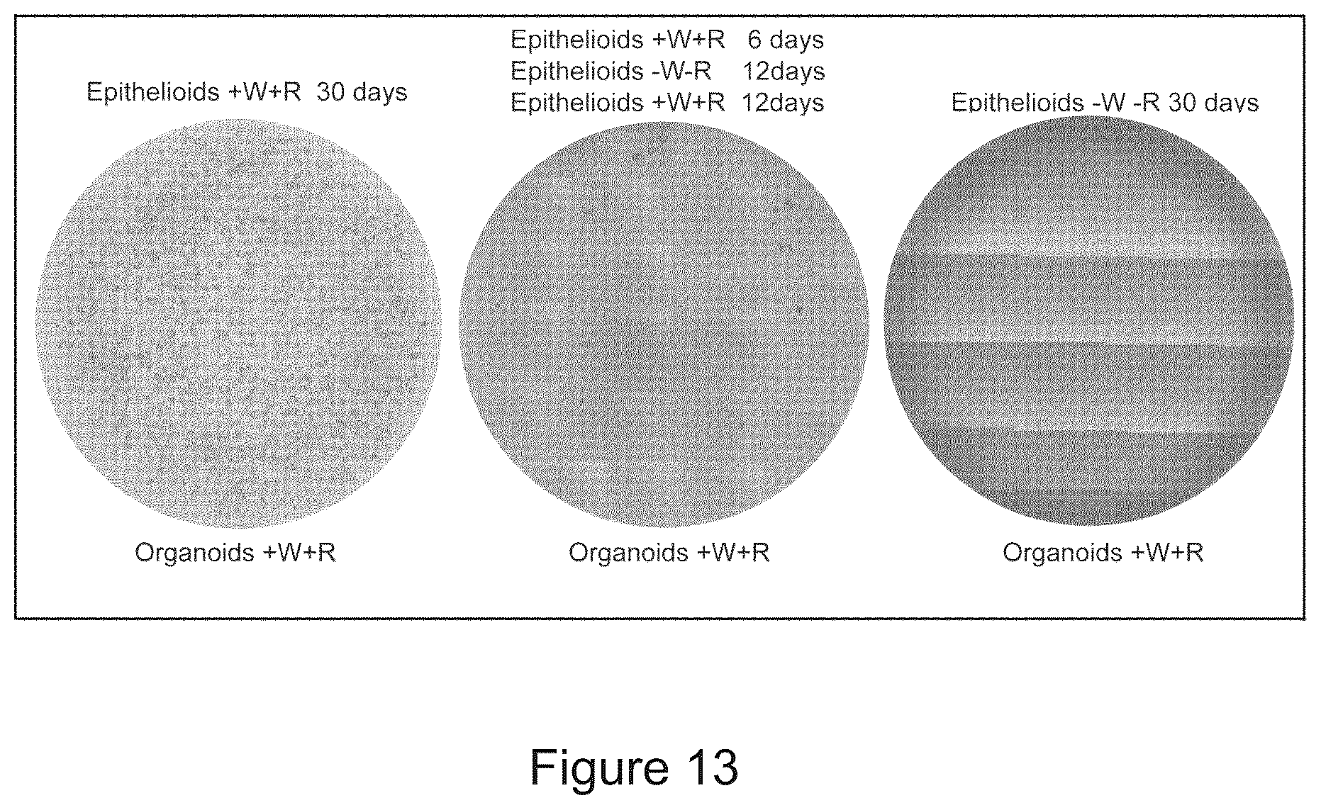 Patent US12351829 Figure 13 – Generation, proliferation and expansion of epithelial cells from primary tissue into mucosoid cultures