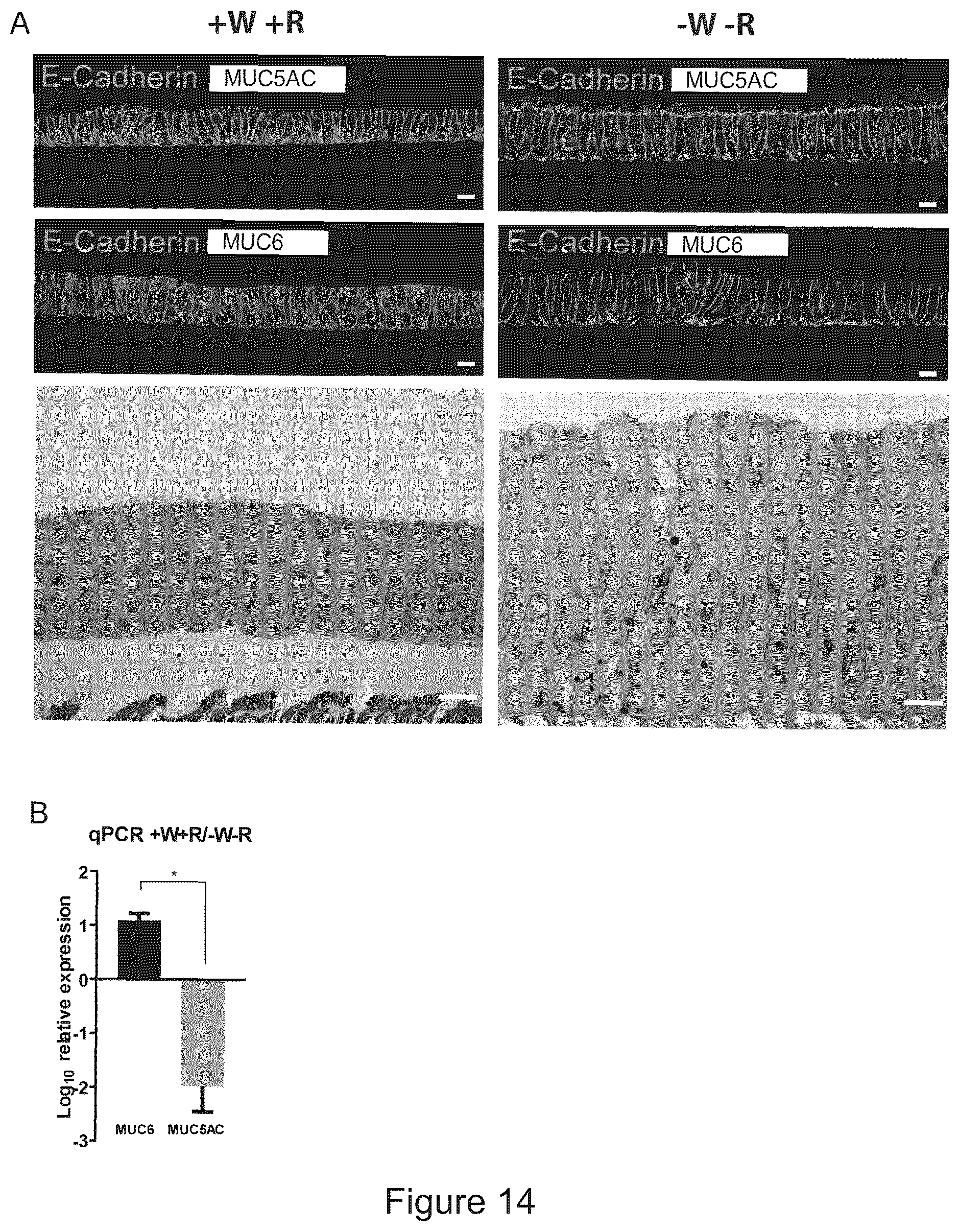 Patent US12351829 Figure 14 – Generation, proliferation and expansion of epithelial cells from primary tissue into mucosoid cultures