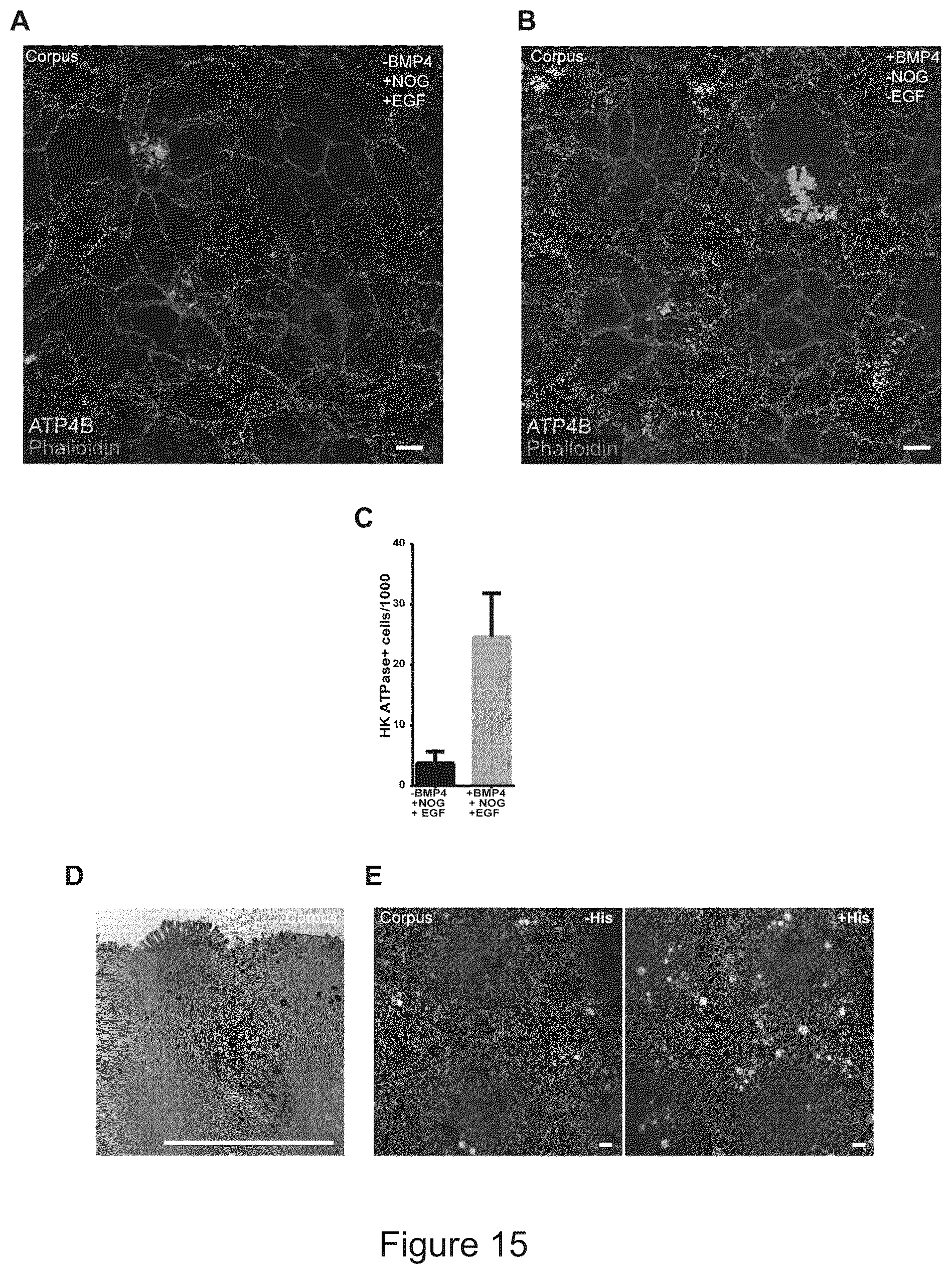 Patent US12351829 Figure 15 – Generation, proliferation and expansion of epithelial cells from primary tissue into mucosoid cultures
