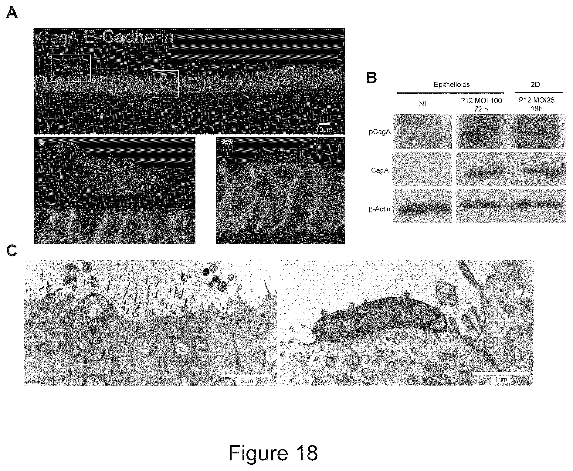 Patent US12351829 Figure 18 – Generation, proliferation and expansion of epithelial cells from primary tissue into mucosoid cultures