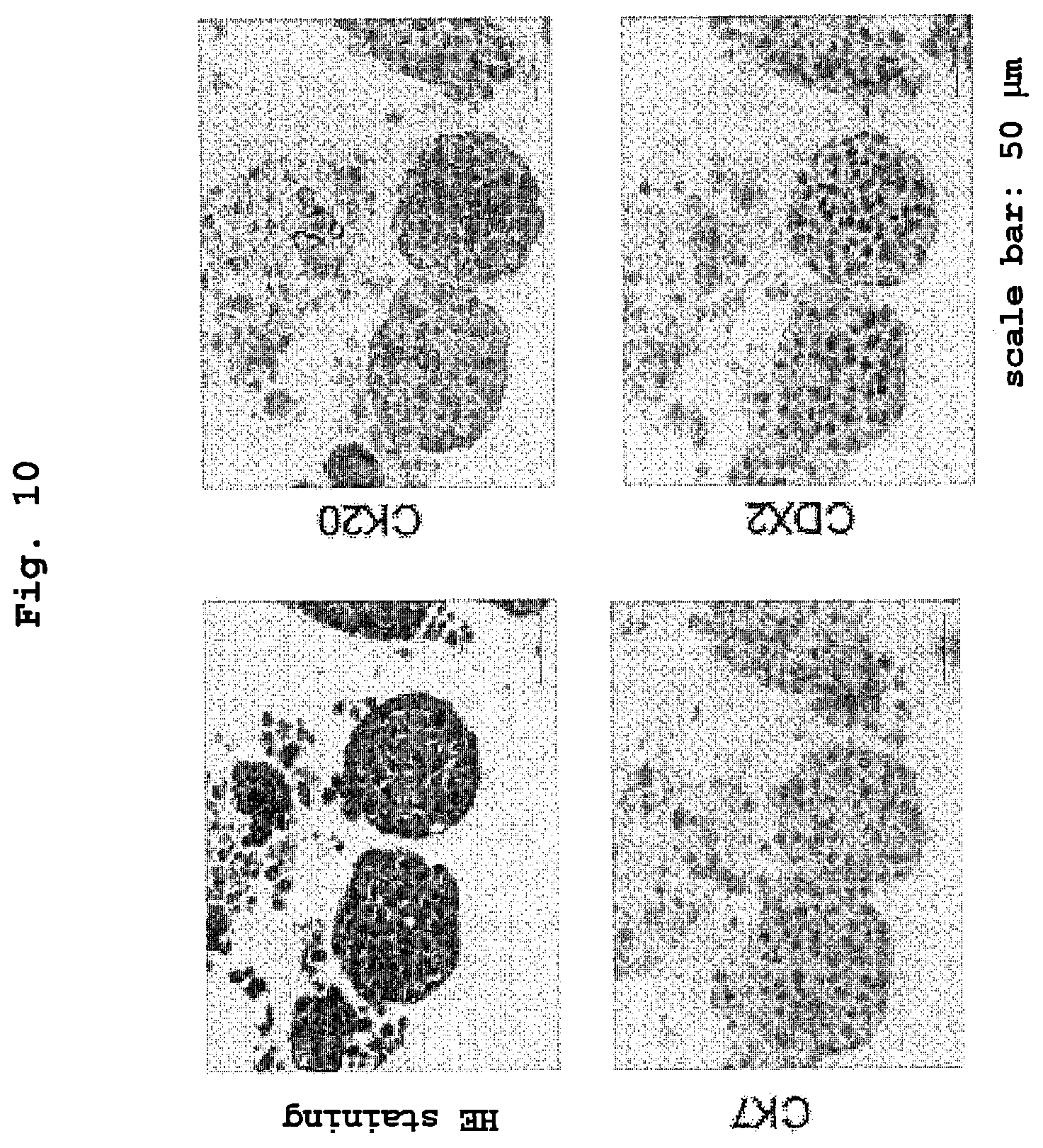 Patent US12351830 Figure 10 – Method for maintaining and amplifying colon cancer stem cells and method for inducing colon cancer organoid