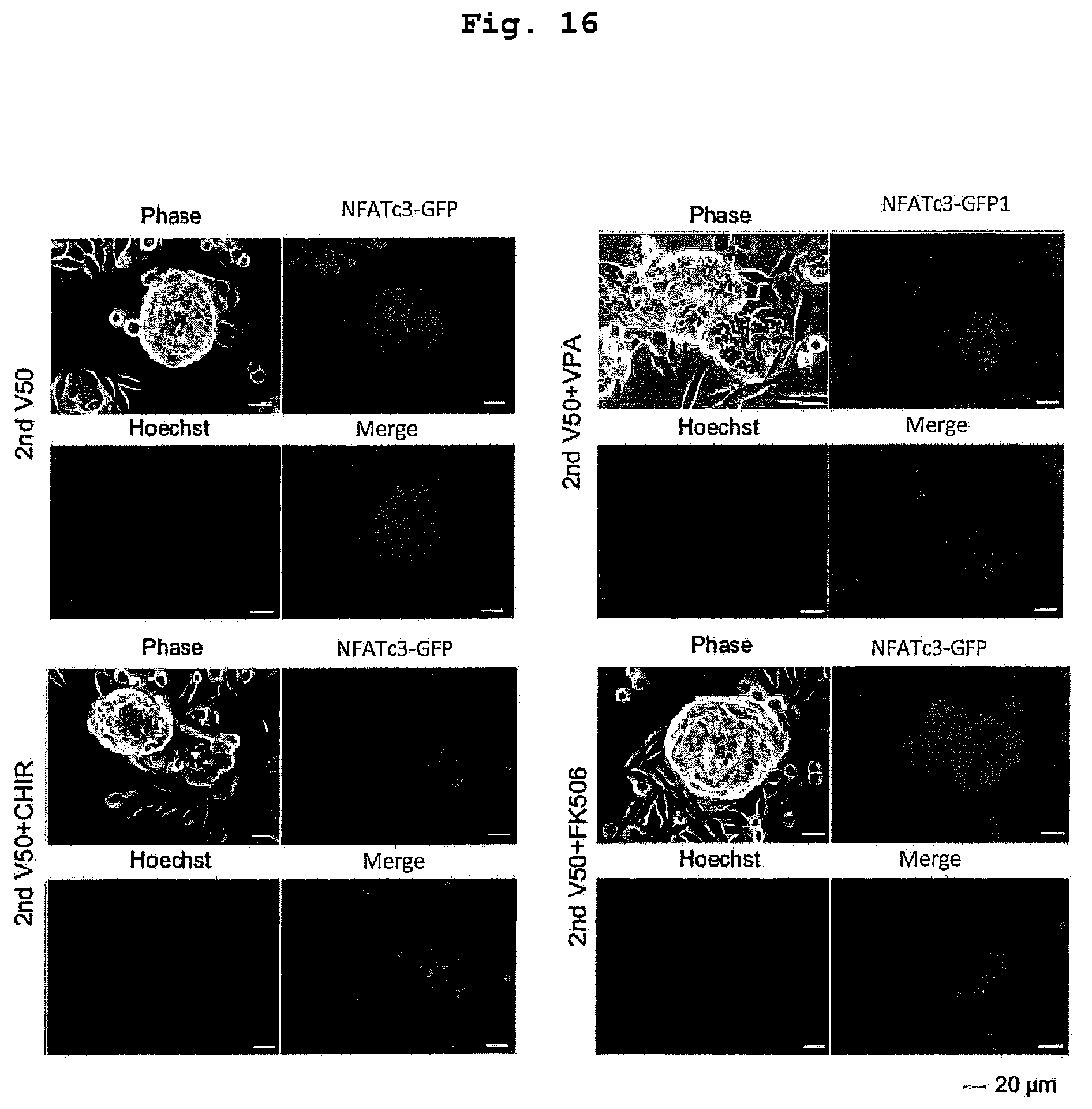 Patent US12351830 Figure 15 – Method for maintaining and amplifying colon cancer stem cells and method for inducing colon cancer organoid
