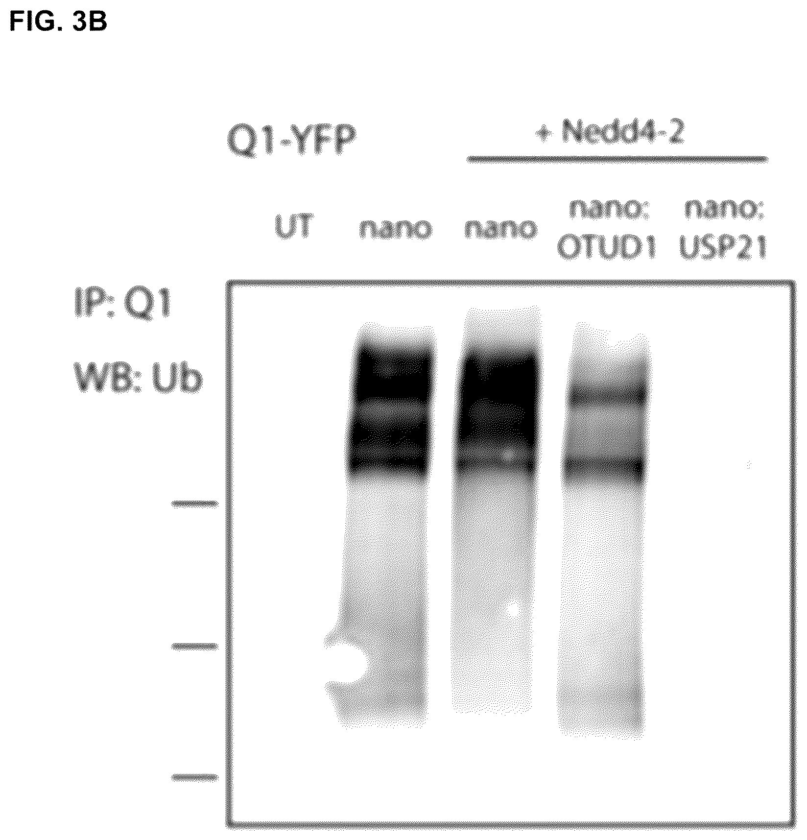 Patent US12351845 Figure 4 – Compositions and methods for using engineered deubiquitinases for probing ubiquitin-dependent cellular processes