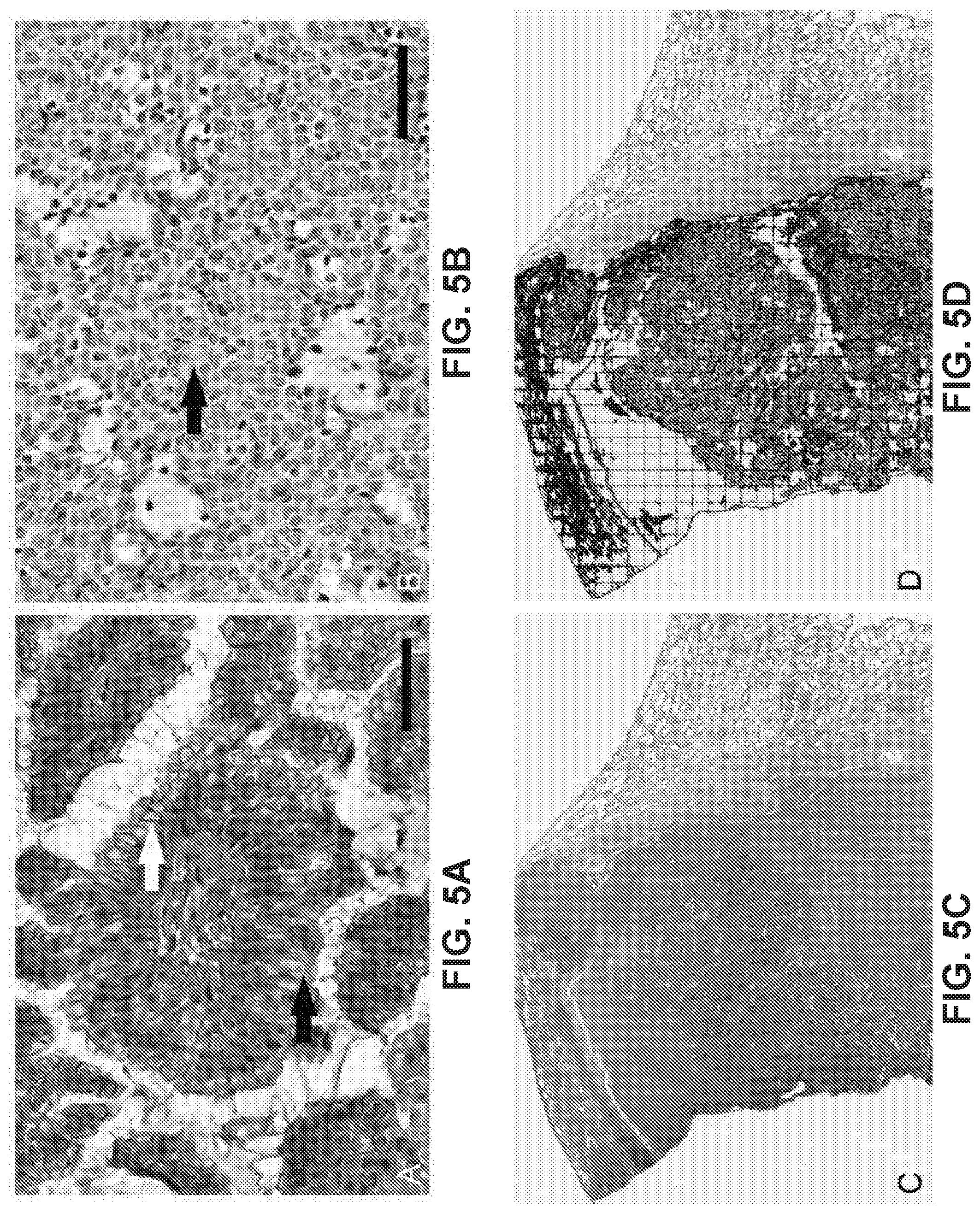 Patent US12351878 Figure 16 – Identification of HER2 mutations in lung cancer and methods of treatment