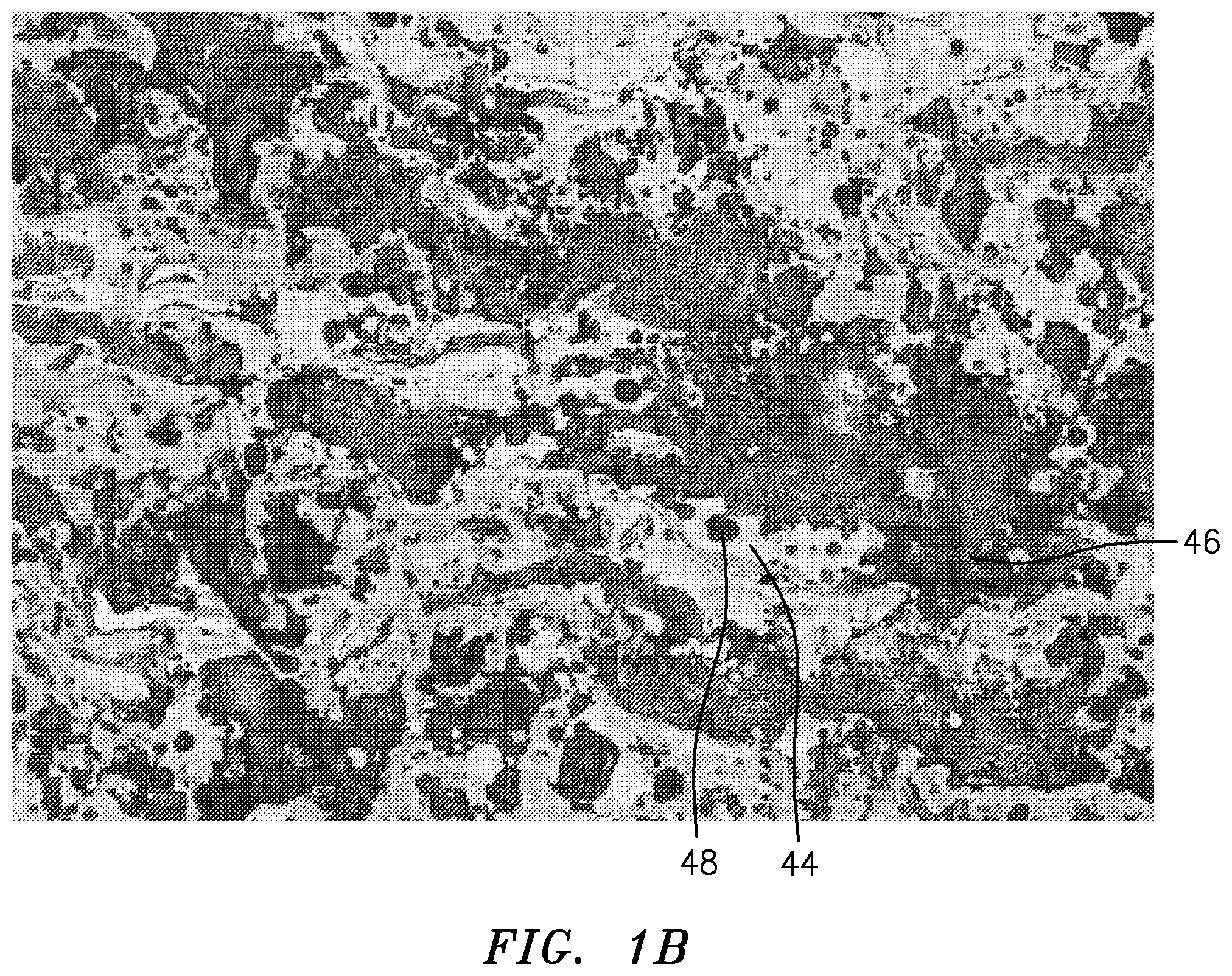 Patent US12351920 Figure 3 – Turbine engine abradable systems