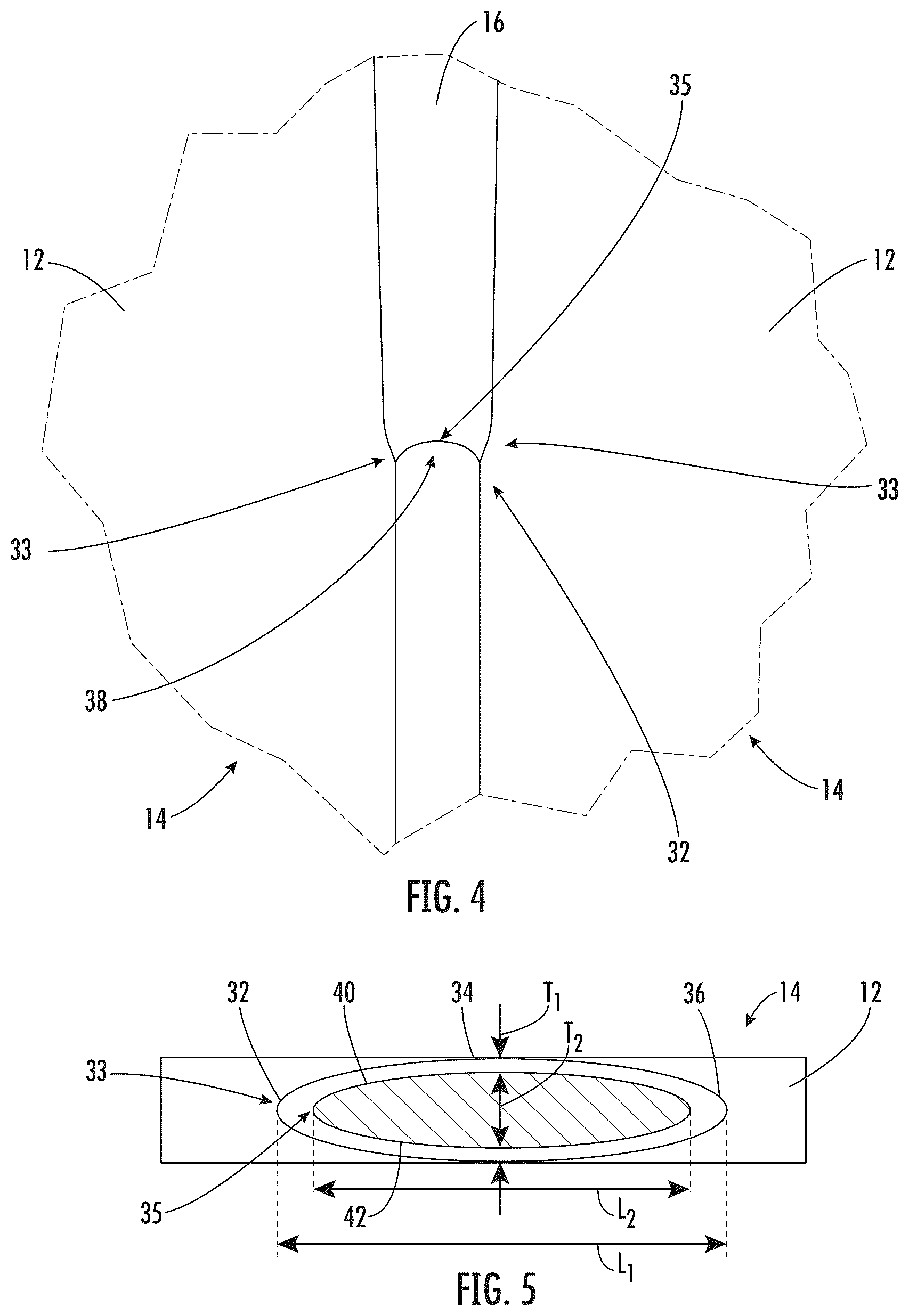 Patent US12353041 Figure 4 – Intermittently bonded ribbon with intermittent bonds created with a wet-on-wet process