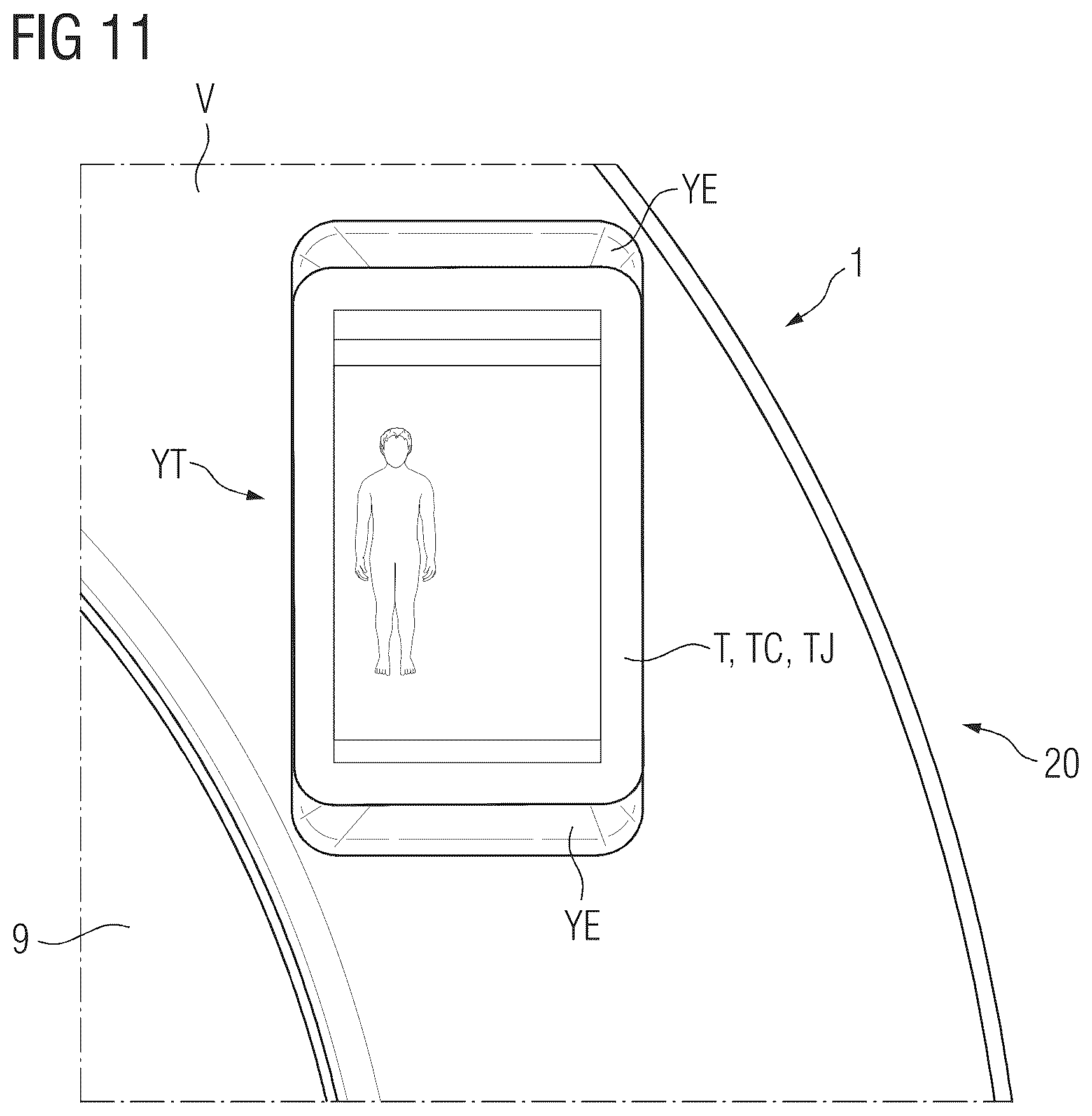 Patent US12353245 Figure 7 – Arrangement with a tablet computer unit and a housing part of a medical imaging apparatus