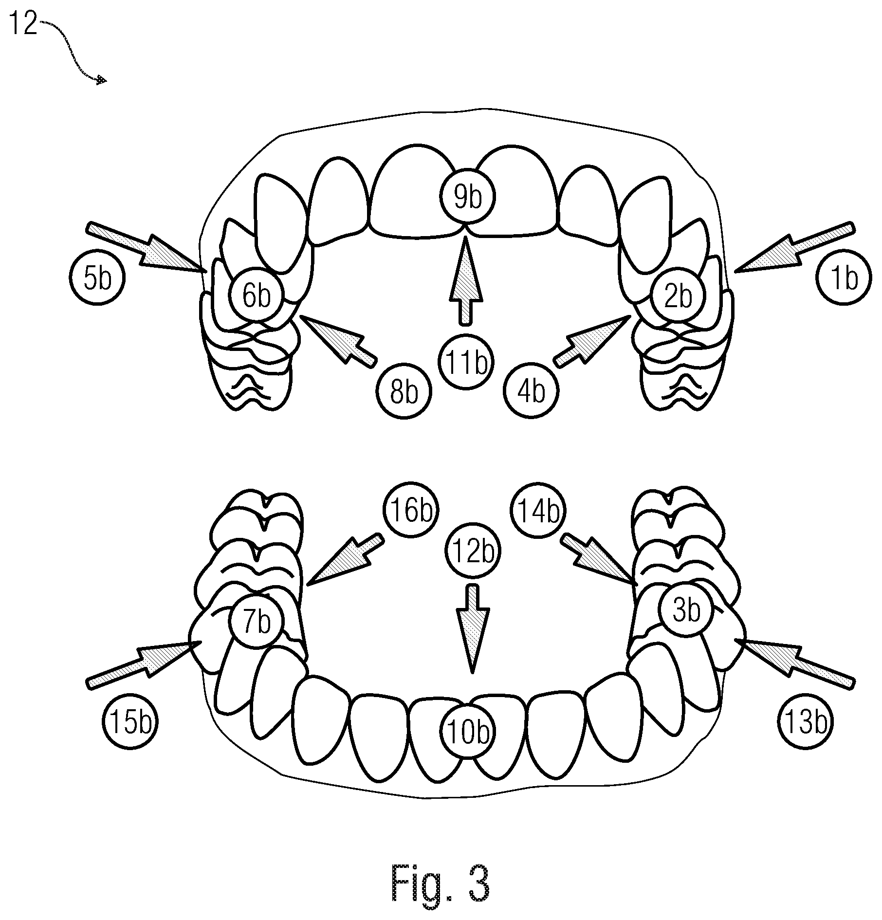Patent US12353975 Figure 3 – Apparatus and method for performing a localization of a movable treatment device