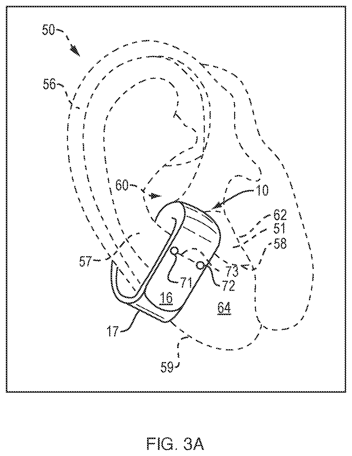 Patent US12356132 Figure 11 – Open-ear headphone