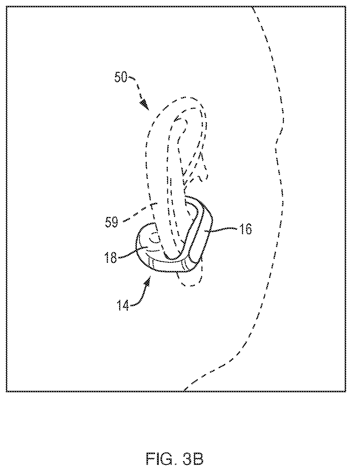 Patent US12356132 Figure 12 – Open-ear headphone