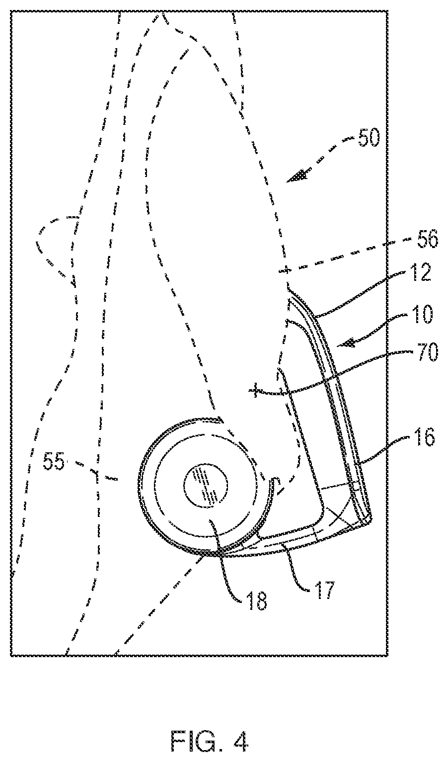 Patent US12356132 Figure 13 – Open-ear headphone