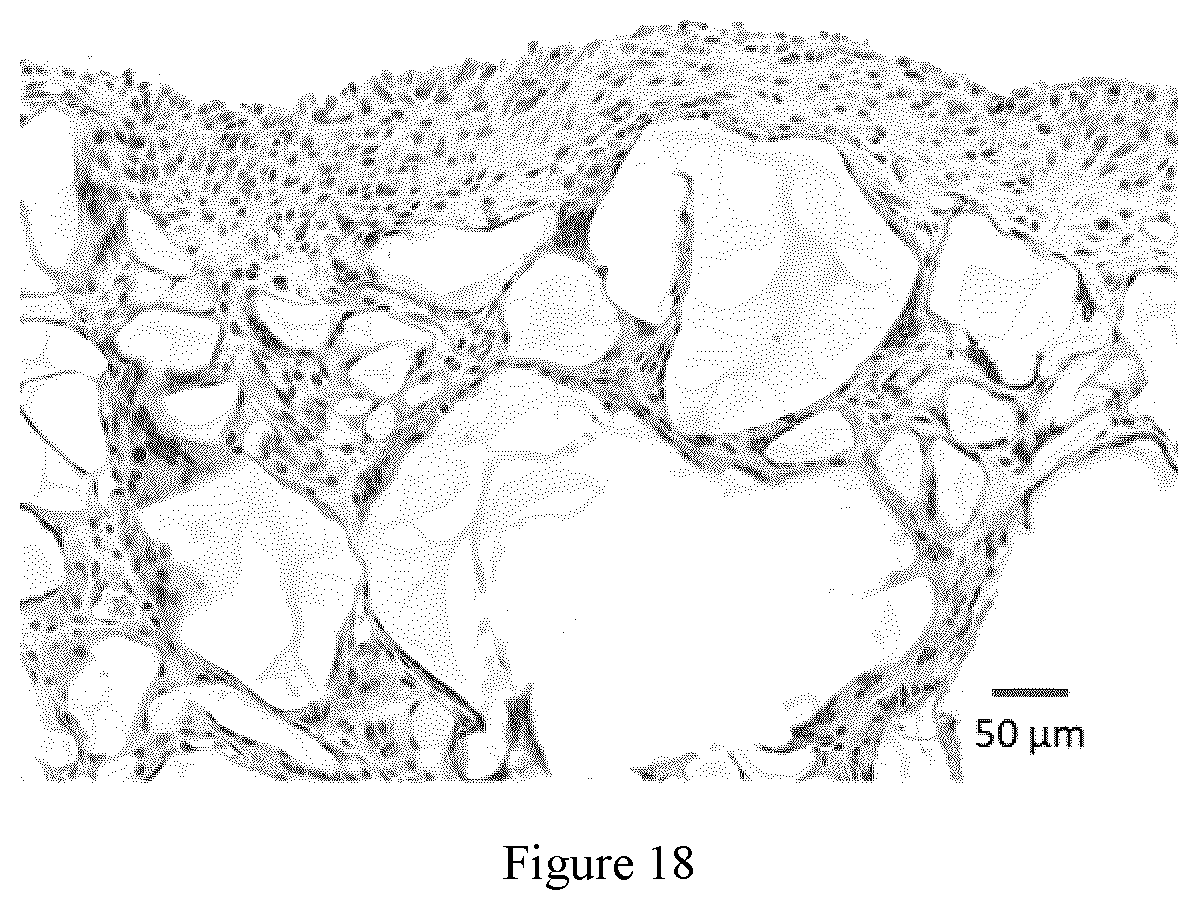 Patent US12359026 Figure 18 – In situ gelling zwitterionic hydrogel compositions, and methods of use thereof