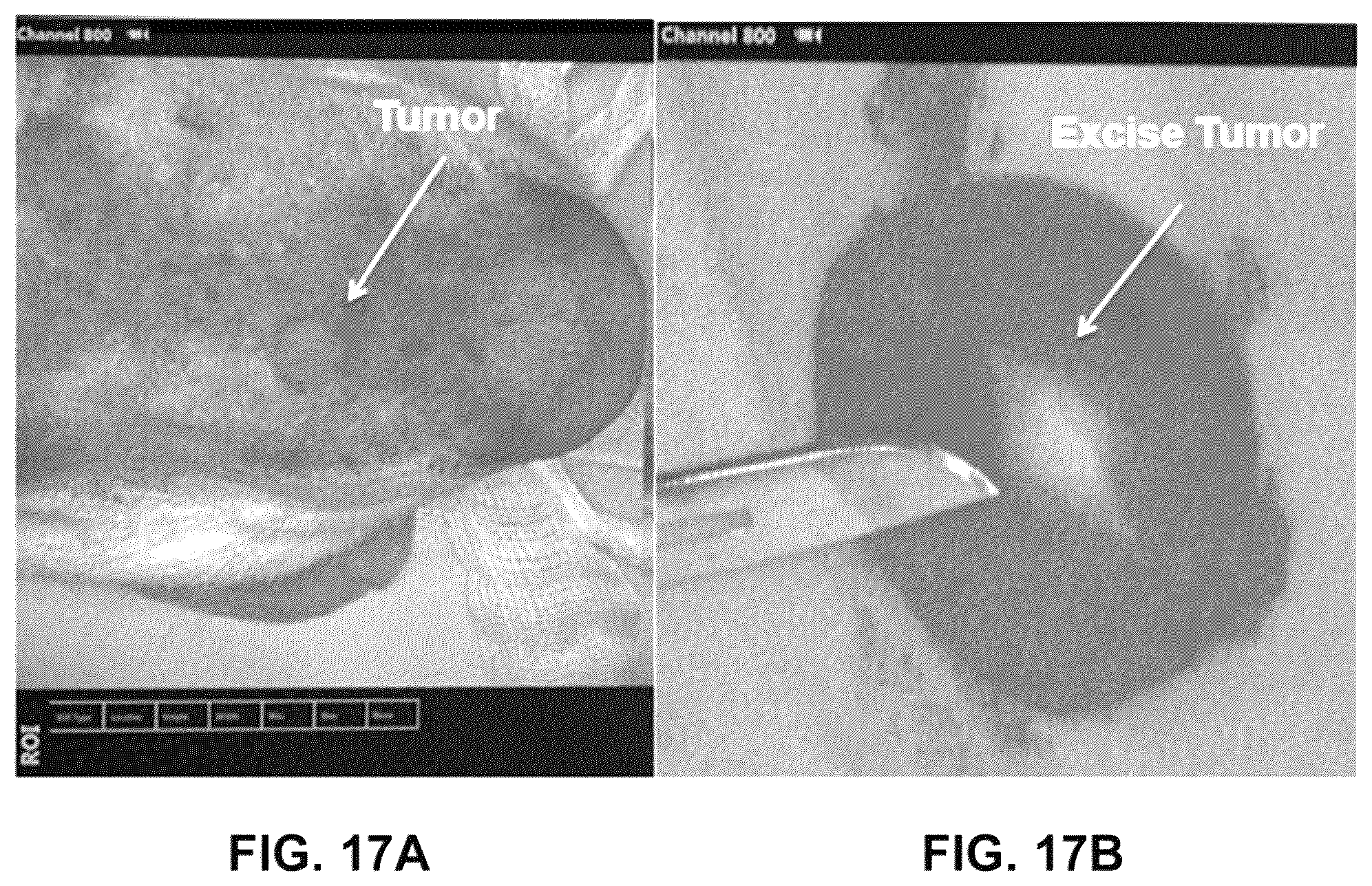 Patent US12359069 Figure 17 – Azacyanine dyes and use thereof