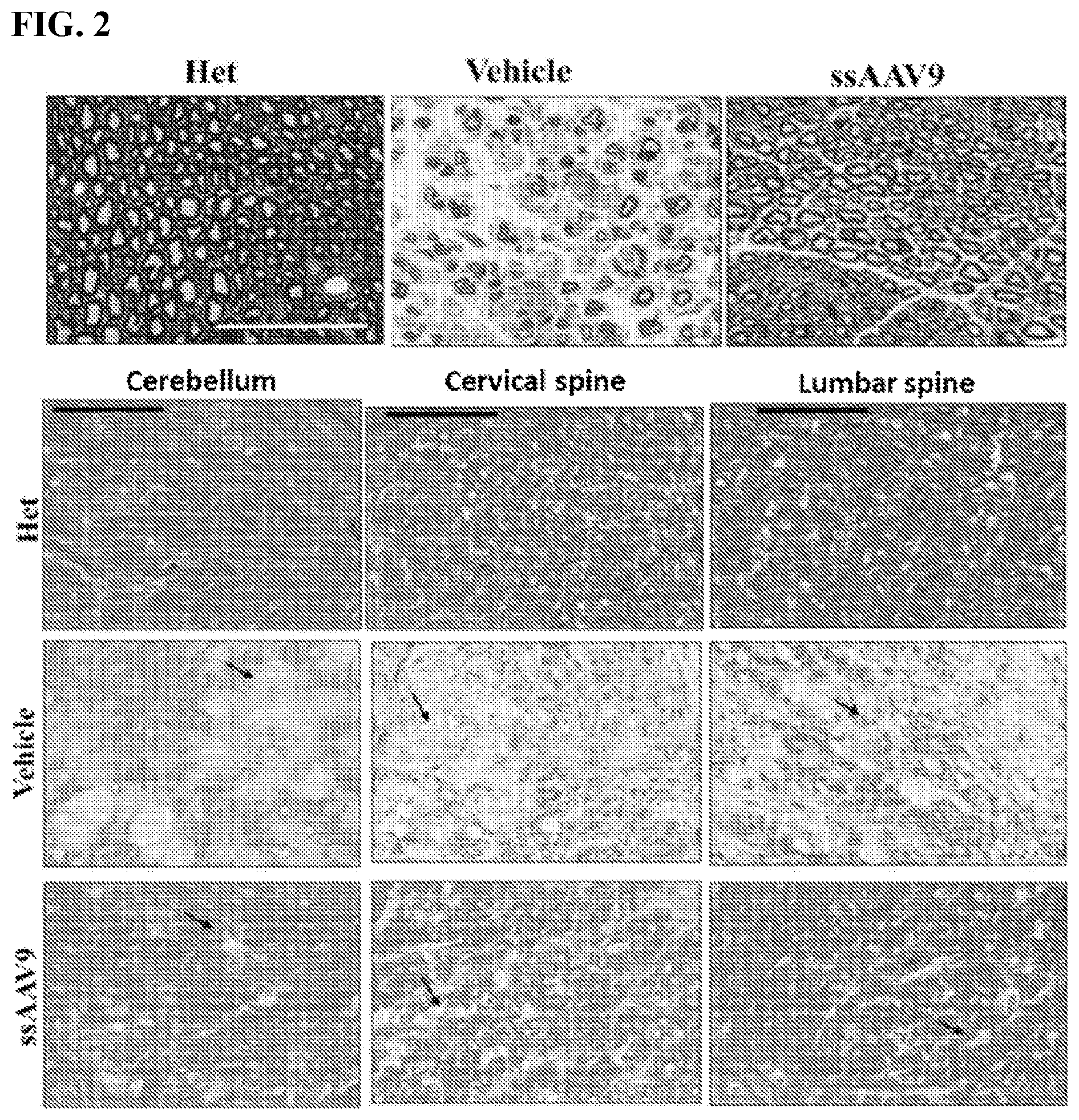 Patent US12359181 Figure 3 – Optimized GALC genes and expression cassettes and their use