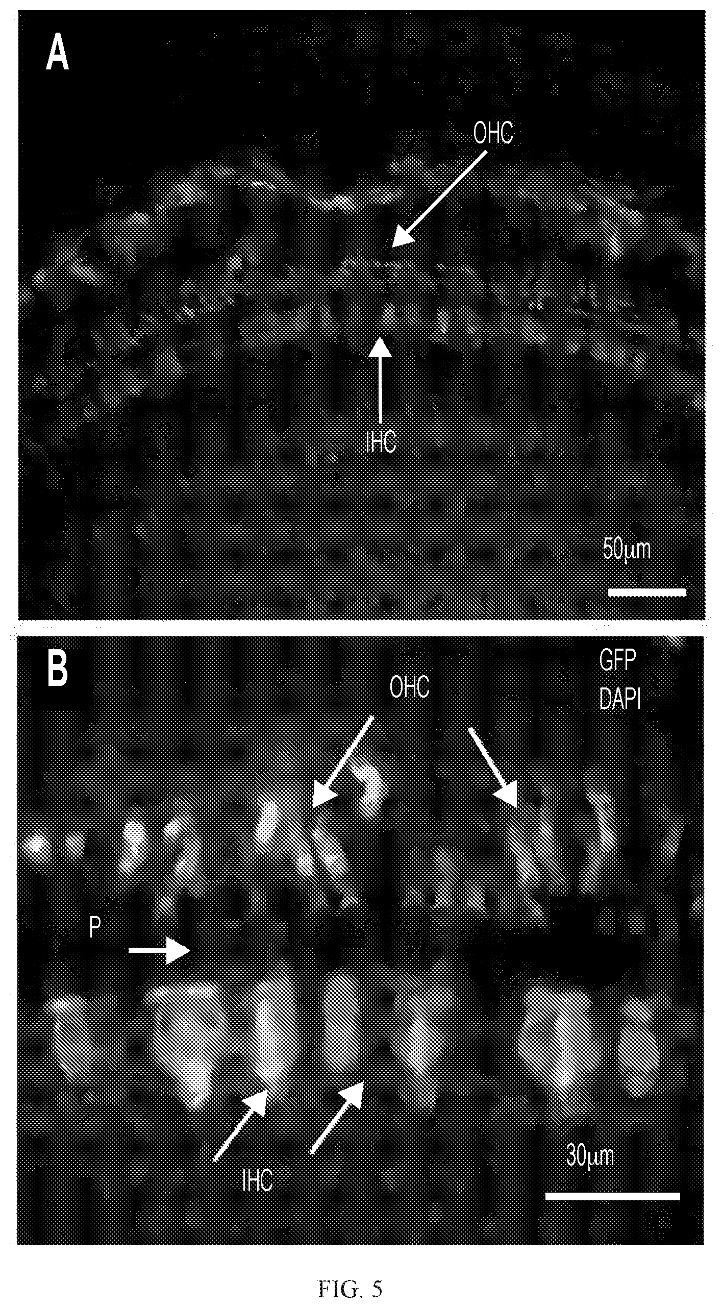 Patent US12359221 Figure 10 – Compositions and methods for expressing otoferlin