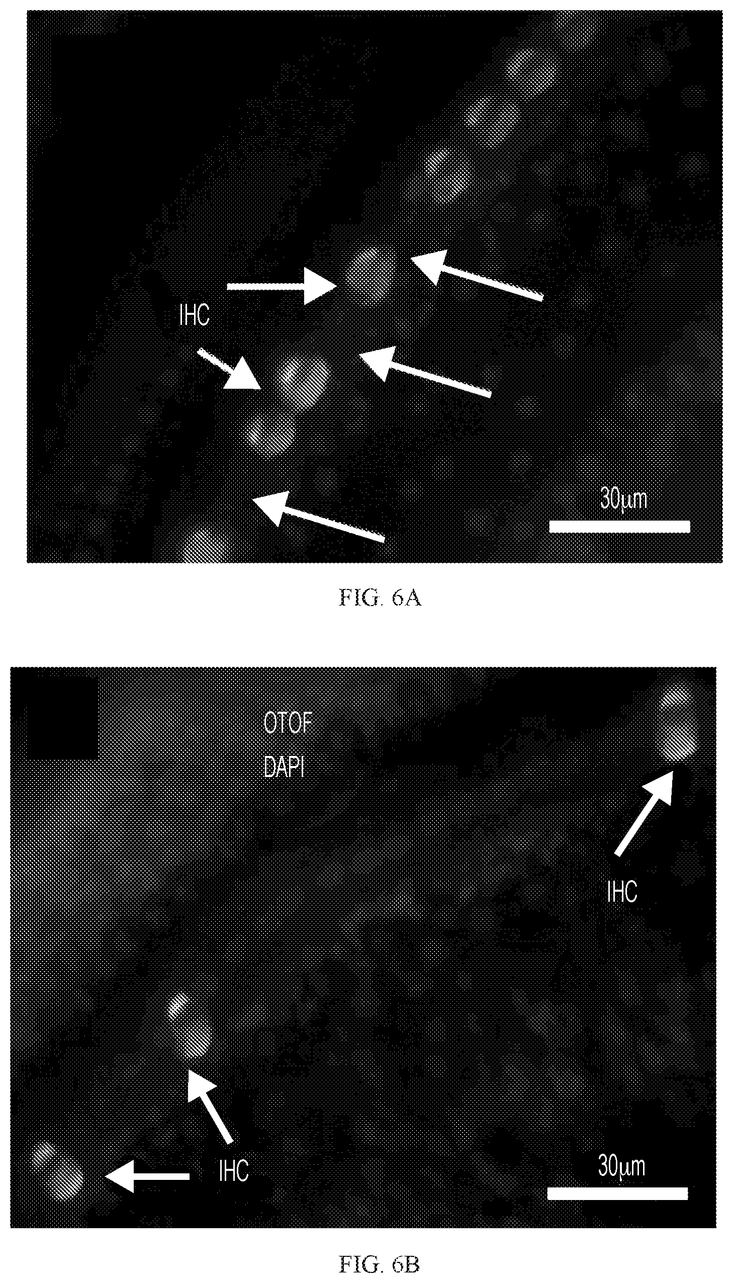 Patent US12359221 Figure 11 – Compositions and methods for expressing otoferlin