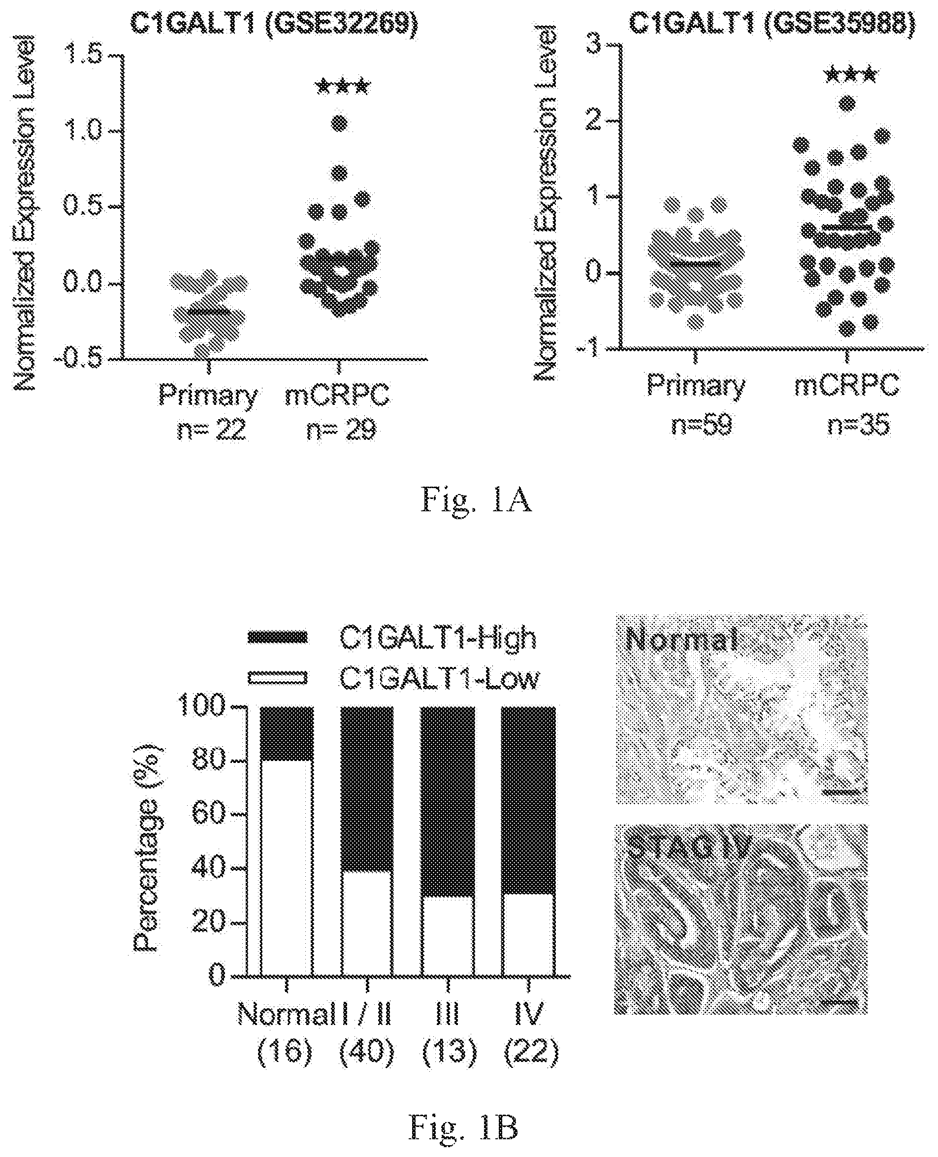 Patent US12359259 Figure 1 – Biomarkers for predicting prostate cancer progression