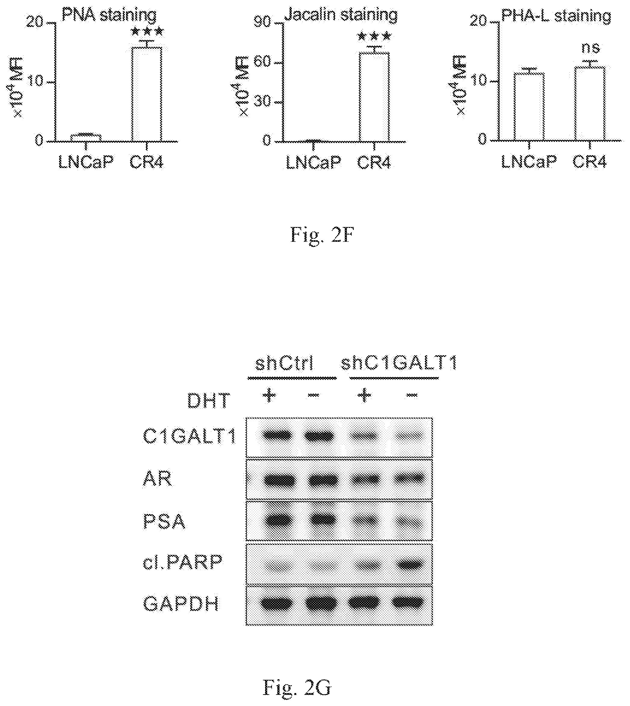Patent US12359259 Figure 5 – Biomarkers for predicting prostate cancer progression