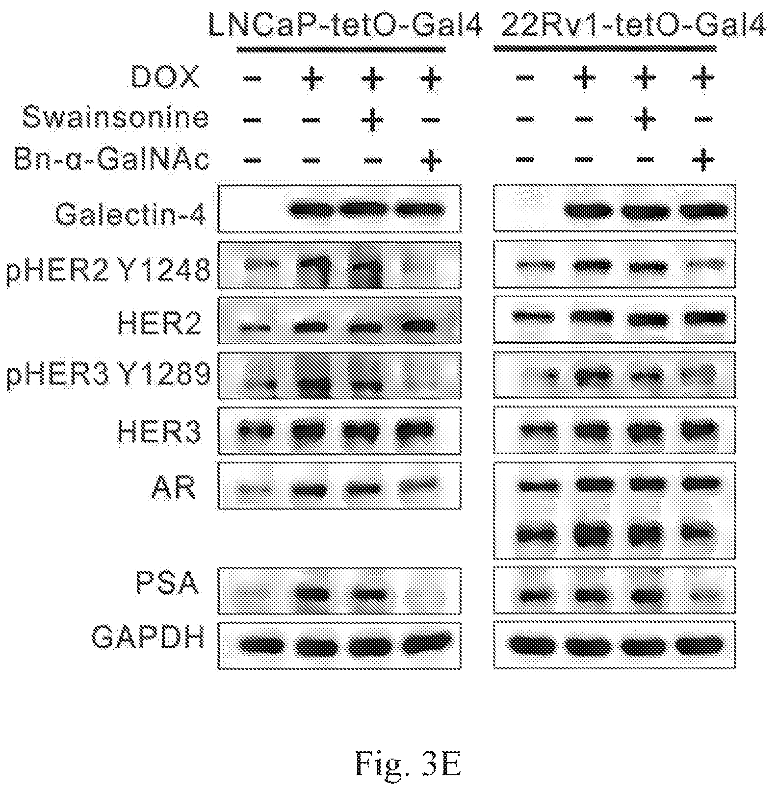 Patent US12359259 Figure 8 – Biomarkers for predicting prostate cancer progression
