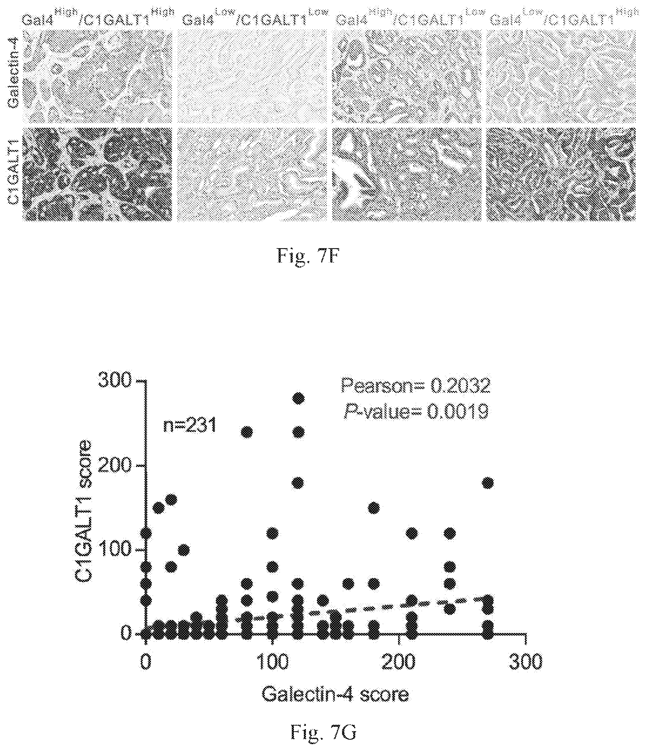 Patent US12359259 Figure 20 – Biomarkers for predicting prostate cancer progression