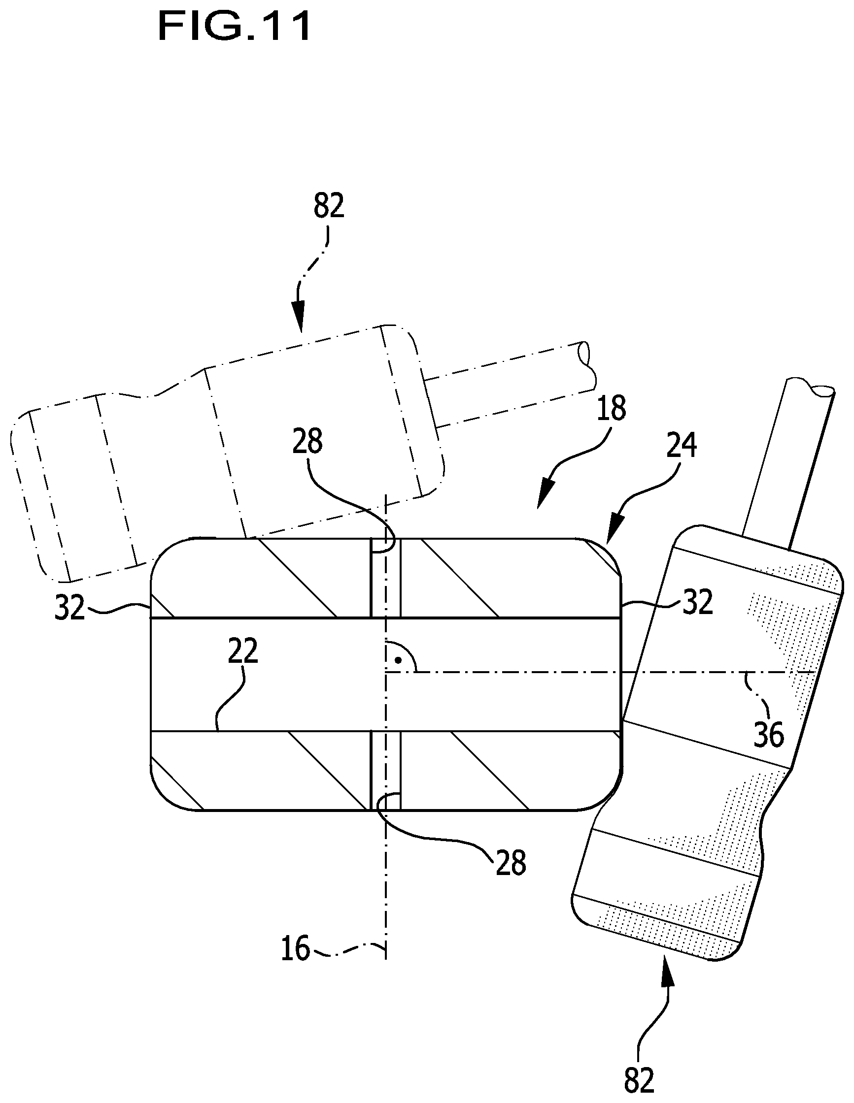 Patent US12359270 Figure 7 – Medical instrument and method for producing a medical instrument