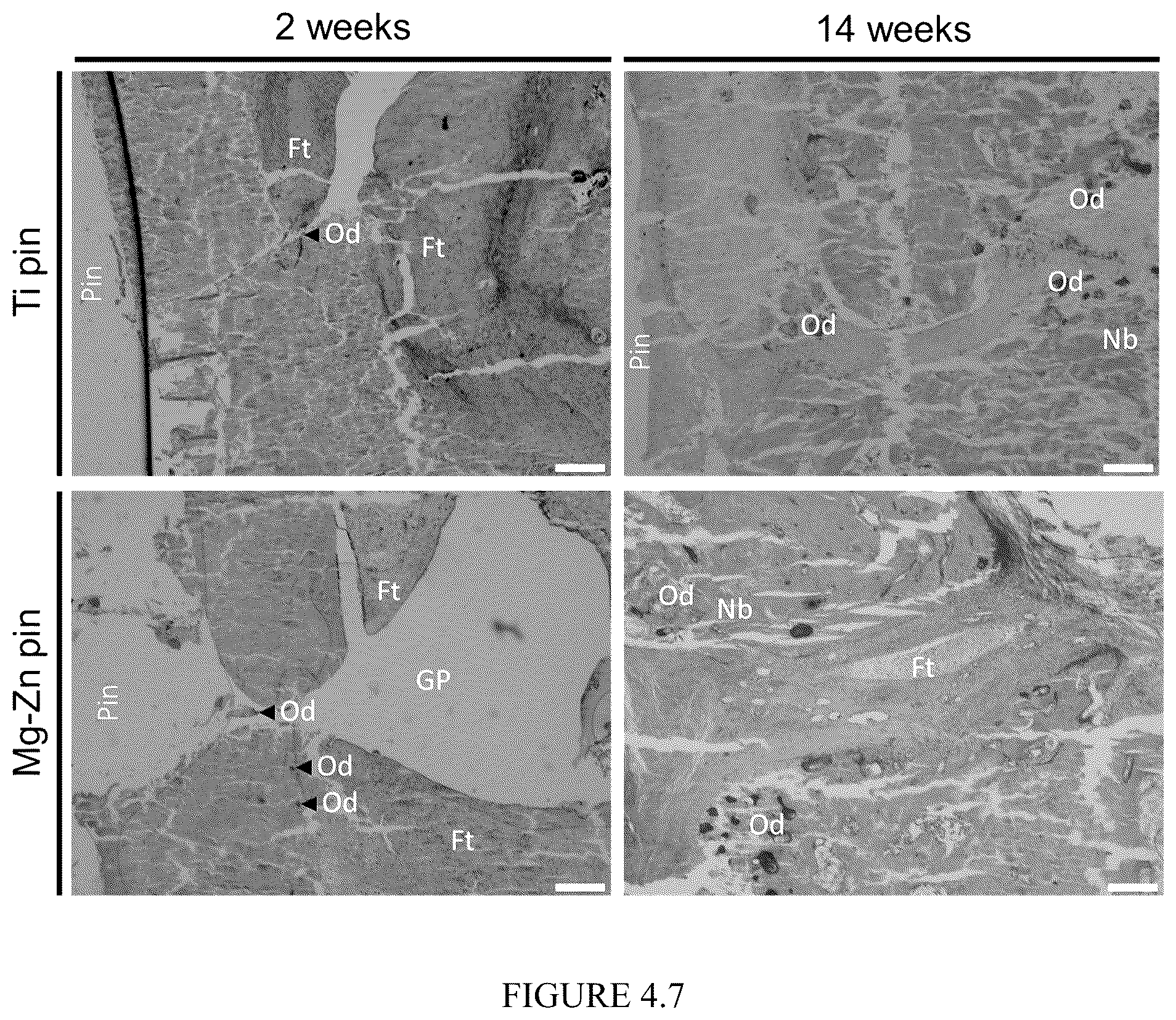 Patent US12359287 Figure 20 – Properties and parameters of novel biodegradable metallic alloys